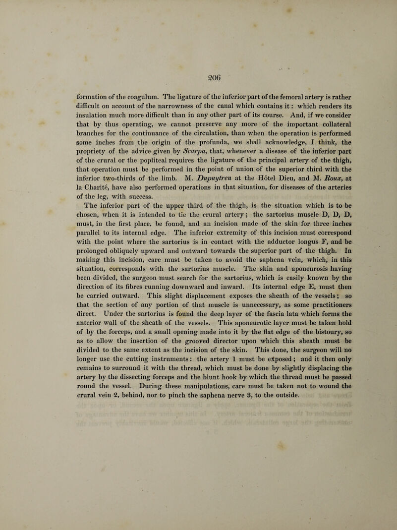 formation of the coagulum. The ligature of the inferior part of the femoral artery is rather difficult on account of the narrowness of the canal which contains it : which renders its insulation much more difficult than in any other part of its course. And, if we consider that by thus operating, we cannot preserve any more of the important collateral branches for the continuance of the circulation, than when the operation is performed some inches from the origin of the profunda, we shall acknowledge, I think, the propriety of the advice given by Scarpa, that, whenever a disease of the inferior part of the crural or the popliteal requires the ligature of the principal artery of the thigh, that operation must be performed in the point of union of the superior third with the inferior two-thirds of the limb. M. Dupuiytren at the Hôtel Dieu, and M. Roux, at la Charité, have also performed operations in that situation, for diseases of the arteries of the leg, with success. The inferior part of the upper third of the thigh, is the situation which is to be chosen, when it is intended to tie the crural artery ; the sartorius muscle D, D, D, must, in the first place, be found, and an incision made of the skin for three inches parallel to its internal edge. The inferior extremity of this incision must correspond with the point where the sartorius is in contact with the adductor longus F, and be prolonged obliquely upward and outward towards the superior part of the thigh. In making this incision, care must be taken to avoid the saphena vein, which, in this situation, corresponds with the sartorius muscle. The skin and aponeurosis having been divided, the surgeon must search for the sartorius, which is easily known by the direction of its fibres running downward and inward. Its internal edge E, must then be carried outward. This slight displacement exposes the sheath of the vessels ; so that the section of any portion of that muscle is unnecessary, as some practitioners direct. Under the sartorius is found the deep layer of the fascia lata which forms the anterior wall of the sheath of the vessels. This aponeurotic layer must be taken hold of by the forceps, and a small opening made into it by the flat edge of the bistoury, so as to allow the insertion of the grooved director upon which this sheath must be divided to the same extent as the incision of the skin. This done, the surgeon will no longer use the cutting instruments : the artery 1 must be exposed ; and it then only remains to surround it with the thread, which must be done by slightly displacing the artery by the dissecting forceps and the blunt hook by which the thread must be passed round the vessel. During these manipulations, care must be taken not to wound the crural vein 2, behind, nor to pinch the saphena nerve 3, to the outside.