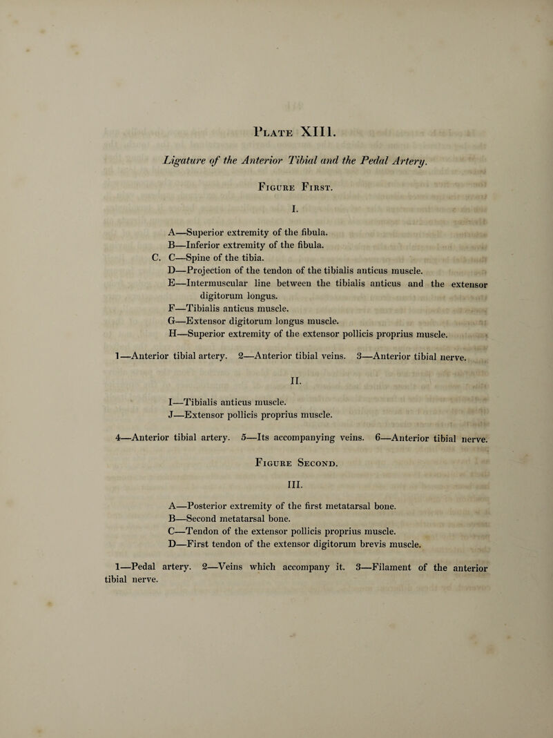 Plate XIII. Ligature of the Anterior Tibial and the Pedal Artery. Figure First. I. A—Superior extremity of the fibula. B—Inferior extremity of the fibula. C. C—Spine of the tibia. D—Projection of the tendon of the tibialis anticus muscle. E—Intermuscular line between the tibialis anticus and the extensor digitorum longus. F—Tibialis anticus muscle. G—Extensor digitorum longus muscle. H—Superior extremity of the extensor pollicis proprius muscle. 1—Anterior tibial artery. 2—Anterior tibial veins. 3—Anterior tibial nerve. II. I—Tibialis anticus muscle. J—Extensor pollicis proprius muscle. 4—Anterior tibial artery. 5—Its accompanying veins. 6—Anterior tibial nerve. Figure Second. III. A—Posterior extremity of the first metatarsal bone. B—Second metatarsal bone. C—Tendon of the extensor pollicis proprius muscle. D—First tendon of the extensor digitorum brevis muscle. 1—Pedal artery. 2—Veins which accompany it. 3—Filament of the anterior tibial nerve.