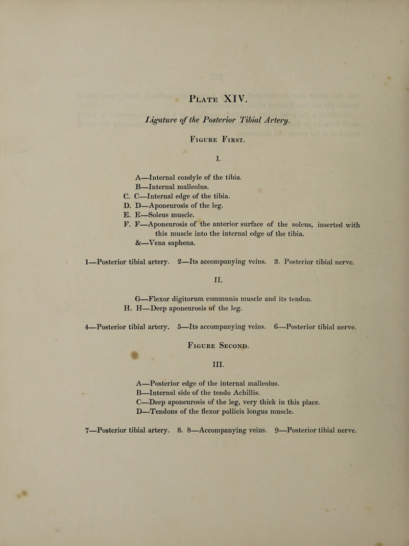 Plate XIV. lAgature of the Posterior Tibial Artery. Figure First. I. A—Internal condyle of the tibia. B—Internal malleolus. C. C—Internal edge of the tibia. D. D—Aponeurosis of the leg. E. E—Soleus muscle. F. F—Aponeurosis of the anterior surface of the soleus, inserted with this muscle into the internal edge of the tibia. &—Vena saphena. 1—Posterior tibial artery. 2—Its accompanying veins. 3. Posterior tibial nerve. II. G—Flexor digitorum communis muscle and its tendon. H. H—Deep aponeurosis of the leg. 4—Posterior tibial artery. 5—Its accompanying veins. 6—Posterior tibial nerve. Figure Second. III. A—Posterior edge of the internal malleolus. B—Internal side of the tendo Achillis. C—Deep aponeurosis of the leg, very thick in this place. D—Tendons of the flexor pollicis longus muscle.