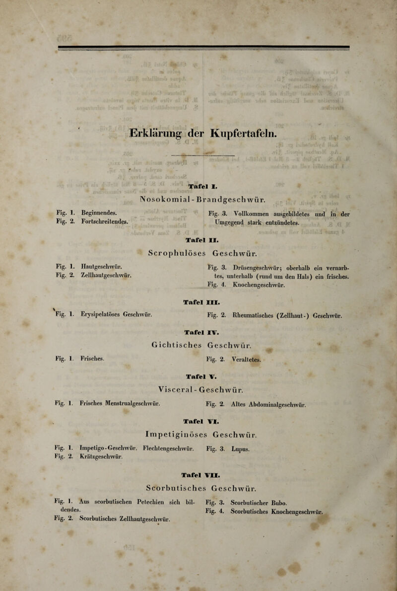 i Erklärung der Kupfertafeln Tafel I. Nosokomial - Brandgeschwür. Fig. 1. Beginnendes. Fig. 3. Vollkommen ausgebildetes und in der Fig. 2. Fortschreitendes. Umgegend stark entzündetes. Tafel II. Scrophulöses Geschwür. Fig. 1. Hautgeschwür. Fig. 3. Drüsengeschwür; oberhalb ein vernarb- Fig. 2. Zellhautgeschwür. tes, unterhalb (rund um den Hals) ein frisches. Fig. 4. Knochengeschwür. Tafel III. v Fig. 1. Erysipelatöses Geschwür. Fig. 2. Rheumatisches (Zellhaut-) Geschwür. Tafel IV. Gichtisches Geschwür. Fig. 1. Frisches. Fig. 2. Veraltetes. Tafel V. Visceral - Geschwür. Fig. 1. Frisches Menstrualgeschwür. Fig. 2. Altes Abdominalgeschwür. Tafel VI. Impetiginöses Geschwür. Fig. 1. Impetigo-Geschwür. Flechlengeschwür. Fig. 3. Lupus. Fig. 2. Krätzgeschwür. Tafel VII. Scorbutisches Geschwür. Fig. 1. Aus scorbutischen Petechien sich bil¬ dendes. Fig. 2. Scorbutisches Zellhautgeschwür. Fig. 3. Scorbutischer Bubo. Fig. 4. Scorbutisches Knochengeschwür.