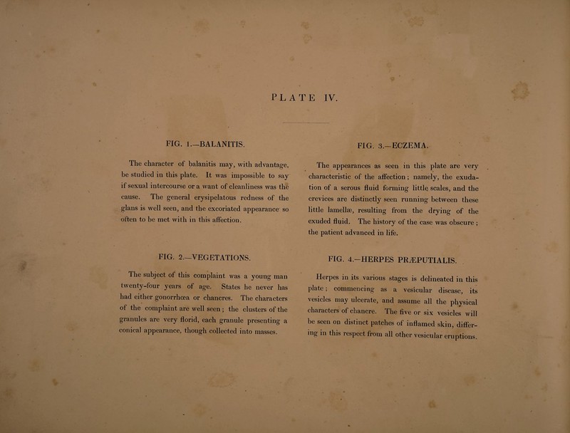 \ PART I. * - BLENNORRHAGIA PLATE IV. / ♦