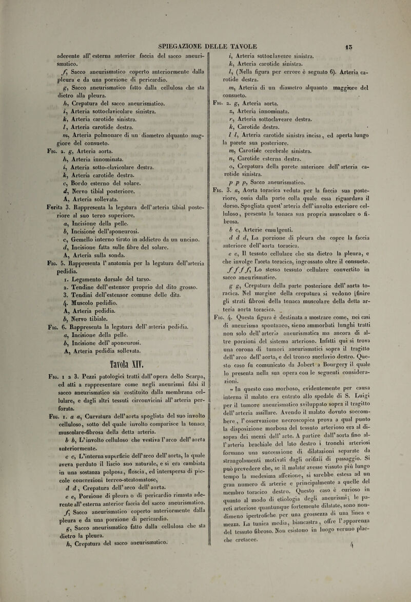 aderente all’ esterna anteri or faccia del sacco aneuri¬ smatico. J,j Sacco aneurismatico coperto anteriormente dalla pleura e da una porzione di pericardio. g, Sacco aneurismatico fatto dalla cellulosa che sta dietro alla pleura. A, Crepatura del sacco aneurismatico, i, Arteria sottoclavicolare sinistra. A, Arteria carotide sinistra. Z, Arteria carotide destra. m, Arteria polmonare di un diametro alquanto mag¬ giore del consueto. Fig. 2. g, Arteria aorta. A, Arteria innominata, i, Arteria sotto-clavicolare desti’a. A, Arteria carotide destra, e, Bordo esterno del solare. éZ, Nervo tibial posteriore. A, Arteria sollevata. Ferita 3. Rappresenta la legatura dell’arteria tibial poste¬ riore al suo terzo superiore, a, Incisione della pelle. A, Incisione dell’aponeurosi. c, Gemello interno tirato in addietro da un uncino. <Z, Incisione fatta sulle fibre del solare. A, Arteria sulla sonda. Fio. 5. Rappresenta 1’ anatomia per la legatura dell’arteria pedidia. 1. Legamento dorsale del tarso. 2. Tendine dell’estensor proprio del dito grosso. 3. Tendini dell’estensor comune delle dita. 4. Muscolo pedidio. A, Arteria pedidia. A, Nervo tibiale. Fig. 6. Rappresenta la legatura dell’aiteria pedidia. a, Incisione della pelle. A, Incisione dell’ aponeurosi. A, Arteria pedidia sollevata. Tavola XIV. Fig. 1 2 3. Pezzi patologici tratti dall’opera dello Scarpa, ed atti a rappresentare come negli aneurismi falsi il sacco aneurismatico sia costituito dalla membrana cel¬ lulare, e dagli altri tessuti circonvicini all’ arteria per¬ forata. Fig. 1. a a, Curvatura dell’aorta spogliala del suo involto celluloso, sotto del quale involto comparisce la tonaca muscolare-fibrosa della delta arteria. A A, L’involto celluloso che vestiva l’arco dell’aorta anteriormente. c c, L’interna superficie dell’arco dell’aorta, la quale aveva perduto il liscio suo naturale, e si era cambiata in una sostanza polposa, floscia, ed interspersa di pic¬ cole concrezioni terreo-steatomatose, d d, Crepatura dell’arco dell’aorta. e e, Porzione di pleura o di pericardio rimasta ade¬ rente all’ esterna anlerior faccia del sacco aneurismatico. /, Sacco aneurismatico coperto anteriormente dalla pleura e da una porzione di pericardio. g, Sacco aneurismatico fatto dalla cellulosa che sta dietro la pleura. i, Arteria soltoclaveare sinistra. A, Arteria carotide sinistra. Z, (Nella figura per errore è segnato 6). Arteria ca¬ rotide destra. m, Arteria di un diametro alquanto maggiore del consueto. Fig. 2. g, Arteria aorta. z, Arteria innominata. r, Arteria sottoclaveare destra. A, Carotide destra. I Z, Arteria carotide sinistra incisa, ed aperta lungo la parete sua posteriore. m, Carotide cerebrale sinistra. n, Carotide esterna destra. o, Crepatura della parete anteriore dell’ arteria ca¬ rotide sinistra. p p p, Sacco aneurismatico. Fig. 3. a, Aorta toracica veduta per la faccia sua poste¬ riore, ossia dalla parie colla quale essa riguardava il dorso. Spogliata quest’arteria dell’involto esteriore cel¬ luloso, presenta la tonaca sua propria muscolare o fi¬ brosa. A c, Arterie emù lgenti. d d rZ, La porzione di pleura che copre la faccia anteriore dell’aorta toracica. e e, Il tessuto cellulare che sta dietro la pleura, e che involge l’aorta toracica, ingrossato oltre il consueto. ffjf Lo stesso tessuto cellulare convertito in sacco aneurismatico. g g, Crepatura della parte posteriore dell’ aorta to¬ racica. Nel margine della crepatura si vedono (finire gli strati fibrosi della tonaca muscolare della detta ar¬ teria aorta toracica. Fig. 4- Questa figura è destinata a mostrare come, nei casi di. aneurisma spontaneo, sieno ammorbati lunghi tratti non solo dell’arteria aneurismatica ma ancora di al¬ tre porzioni del sistema arterioso. Infatti qui si trova una corona di tumori aneurismatici sopra il tragitto dell’ arco dell’ aorta, e del tronco succlavio destro. Que¬ sto caso fu comunicalo da Jobert a Bourgery il quale lo presenta nella sua opera con le seguenti considera¬ zioni. » In questo caso morboso, evidentemente per causa interna il malato era entrato allo spedale di S. Luigi per il tumore aneurismatico sviluppalo sopra il tragitto dell’ arteria assillare. Avendo il malato dovuto soccom¬ bere , l’osservazione necroscopica prova a qual punto la disposizione morbosa del tessuto arterioso era al di¬ sopra dei mezzi dell’arte. A partire dall’aorta fino al¬ l’arteria brachiale del lato destro i tronchi arleiiosi formano una successione eli dilatazioni separate ila strangolamenti motivati dagli orifizii di passaggio. Si può prevedere che, se il malato' avesse vissuto più lungo tempo la medesima affezione, si sarebbe estesa ad un gran numero di arterie e principalmente a quelle del membro toracico destro. Questo caso è curioso in quanto al modo di etiologia degli aneurismi} le pa¬ reti arteriose quantunque fortemente dilatate, sono non¬ dimeno ipertrofiche per una grossezza di una linea e mezza. La tunica media, biancastra, offre l’apparenza del tessuto fibroso. Non esistono in luogo veruno plac¬ che cretacee.