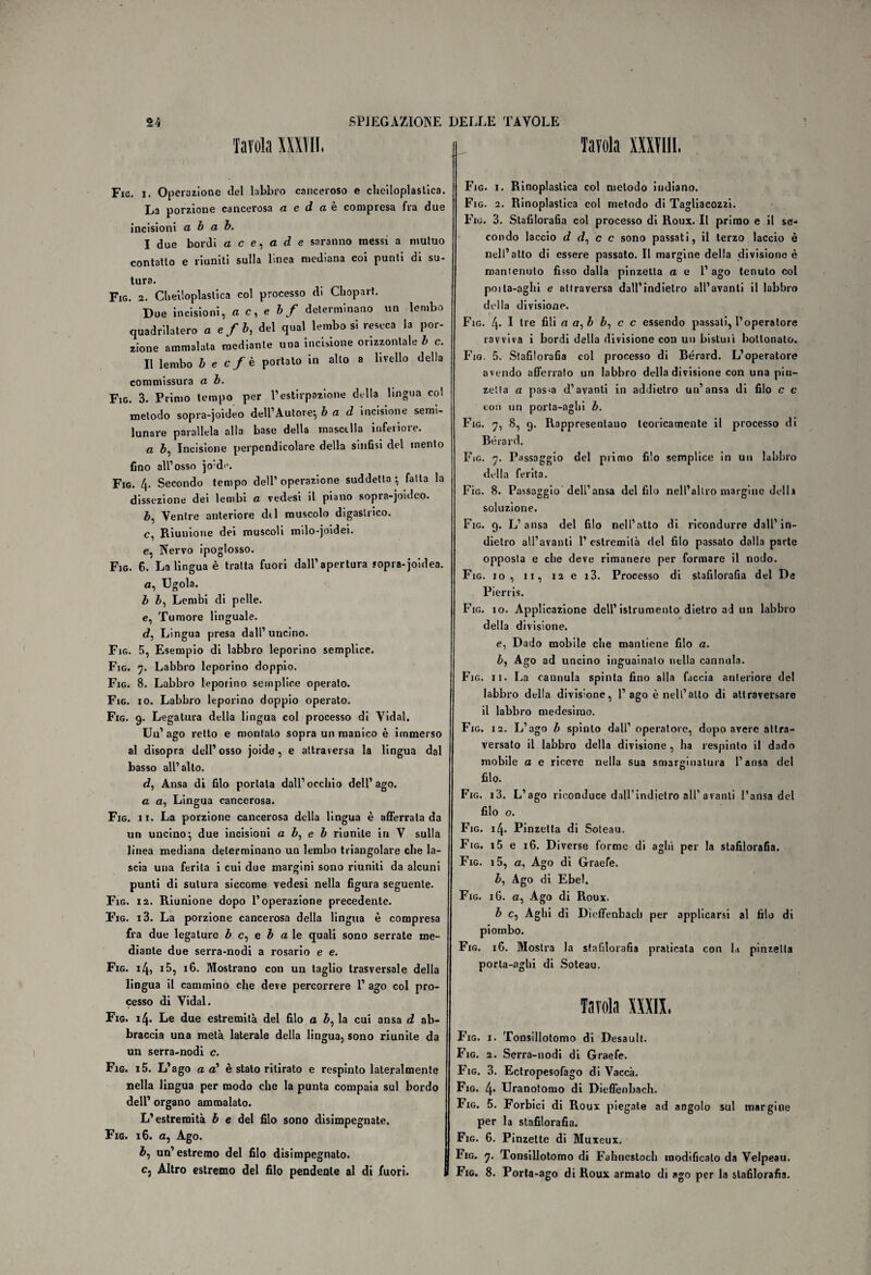Tavola XXXÌII, Fig. i. Operazione del labbro canceroso e cheiloplastica. La porzione cancerosa a e d a è compresa fra due incisioni a b a b. I due bordi a c e, a d e saranno messi a mutuo contatto e riuniti sulla linea mediana coi punti di su¬ tura. Fig. 2. Cheiloplaslica col processo di Chopart. Due incisioni, a c, e bf determinano un lembo quadrilatero a e f b, del qual lembo si reseca la por¬ zione ammalata mediante una incisione orizzontale b c. II lembo b e cf è portato in allo a livello della commissura a b. Fig. 3. Primo tempo per Vestirpazione della lingua col metodo sopra-joideo dell’Autore’, b a d incisione semi¬ lunare parallela alla base della mascella infeiioie. a b, Incisione perpendicolare della sinfisi del mento fino all’osso jo'de. Fig. 4- Secondo tempo dell’operazione suddetta-, fatta la dissezione dei lembi a vedesi il piano sopra-joideo. Ventre anteriore dii muscolo digastrico. c, Riunione dei muscoli milo-joidei. e, Nervo ipoglosso. Fig. 6. La lingua è tratta fuori dall’apertura sopra-joidea. a, Ugola. b Lembi di pelle. e, Tumore linguale. cf, Lingua presa dall’uncino. Fig. 5, Esempio di labbro leporino semplice. Fig. 7. Labbro leporino doppio. Fig. 8. Labbro leporino semplice operalo. Fig. io. Labbro leporino doppio operato. Fig. 9. Legatura della lingua col processo di Vidal. Un’ago retto e montalo sopra un manico è immerso al disopra dell’osso joide, e aitraversa la lingua dal basso all’alto. d, Ansa di filo portala dall’occhio dell’ago. a a, Lingua cancerosa. Fig. 11. La porzione cancerosa della lingua è afferrala da un uncino^ due incisioni a Z», e b riunite in V sulla linea mediana determinano un lembo triangolare che la¬ scia una ferita i cui due margini sono riuniti da alcuni punti di sutura siccome vedesi nella figura seguente. Fig. 12. Riunione dopo l’operazione precedente. Fig. i3. La porzione cancerosa della lingua è compresa fra due legature b c, e b a le quali sono serrate me¬ diante due serra-nodi a rosario e e. Fig. 14, 15, 16. Mostrano con un taglio trasversale della lingua il cammino che deve percorrere 1’ ago col pro¬ cesso di Vidal. Fig. 14. Le due estremità del filo a b, la cui ansa d ab¬ braccia una metà laterale della lingua, sono riunite da un serra-nodi c. Fig. i5. L’ago a a? è stato ritirato e respinto lateralmente nella lingua per modo che la punta compaia sul bordo dell’ organo ammalato. L’estremità b e del filo sono disimpegnate. Fig. 16. a, Ago. £, un’estremo del filo disimpegnato. Cj Altro estremo del filo pendente al di fuori. Tavola XXXTII1. Fig. 1. Rinoplaslica col metodo indiano. Fig. 2. Rinoplastica col metodo di Tagliacozzi. Fig. 3. Stafilorafia col processo di Roux. Il primo e il se¬ condo laccio d <f, c c sono passati, il terzo laccio è nell’alto di essere passato. Il margine della divisione è mantenuto fisso dalla pinzetta a e l’ago tenuto col poita-aghi e attraversa dall’indietro all’avanti il labbro della divisione. Fig. 4. I tre fili a a,b b, c c essendo passati, l’operatore ravviva i bordi della divisione con uu bisluiì bollonato. Fig. 5. Stafilorafia col processo di Bérard. L’operatore avendo afferrato un labbro della divisione con una pin¬ zetta a pas>a d’avanti in addietro un’ansa di filo c c con un porta-aghi b. Fig. 7, 8, 9. Rappresentano teoricamente il processo di Bérard. Fig. 7. Passaggio del primo filo semplice in un labbro della ferita. Fìg. 8. Passaggio dell’ansa del filo nell’altro margine della soluzione. Fig. 9. L’ansa del filo nell’atto di ricondurre dall’in¬ dietro all’avanti 1’ estremità del filo passalo dalla parte opposta e che deve rimanere per formare il nodo. Fig. io, 11, n e i3. Processo di stafilorafia del De Pierris. Fig. io. Applicazione dell’ islrumenlo dietro ad un labbro della divisione. e, Dado mobile che mantiene filo a. b, Ago ad uncino inguauialo nella cannula. Fig. il. La caunula spinta fino alla faccia anteriore del labbro della divisione, l’ago è nell’alto di attraversare il labbro medesimo. Fig. 12. L’ago b spinto dall’operatore, dopo avere attra¬ versato il labbro della divisione , ha respinto il dado mobile a e riceve nella sua smarginatala l’ansa del filo. Fig. i3. L’ago riconduce dairindielro all’avanti l’ansa del filo o. Fig. 14. Pinzetta di Soteau. Fig. i5 e 16. Diverse forme di aghi per la stafilorafia. Fig. i5, a, Ago di Graefe. b, Ago di Ebel. Fig. iG. a, Ago di Roux. b c, Aghi di D ìeffenbach per applicarsi al filo di piombo. Fig. 16. Mostra la stafilorafia praticata con la pinzetta porta-aghi di Soteau. Tavola XXXIX. Fig. 1. Tousillotomo di Desault. Fig. 2. Serra-nodi di Graefe. Fig. 3. Ectropesofago di Vacca. Fig. 4* Uranotomo di Dieffenbach. Fig. 5. Forbici di Roux piegale ad angolo sul margine per la stafilorafia. Fig. 6. Pinzette di Muxeux. Fig. 7. Tonsillotomo di Fahnestoch modificato da Velpeau. Fig. 8. Porta-ago di Roux armato di ago per la stafilorafia.
