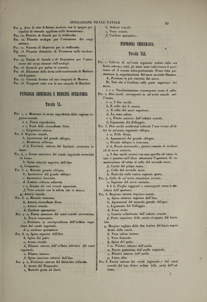 Fio. 9. Aste di osso di balena montate con la spugna per ripulire le cannule applicate nella broncotouiia. Fig. io. Pinzetta di Graefe per la stafilorafìa. Fig. 12. Pinzetta esofagea per 1’estrazione dei corpi estranei. Fig. 12. Pinzetta di Depierris per la stafilorafìa. Fig. i3. Pinzetta dilatatrice di Trousseau nella tracheo¬ tomia. Fig- 14. Uncino di Graefe e di Dupuytren per l’estra¬ zione dei corpi estranei dell’esofago. Fig. i5. Spazzola per pulire le cannule. Fig. 16. Dilatatore della ferita nella traclietomia di Maslieu- vat-Lagemar. Fig. 17. Cannula bivalve col suo trequarti di Moreau. Fig. 18. Trequarti retto con la sua cannula di Bauchet. PiTOLOGIl CHIRURGICA E «DICI! OPERATORIA Tavola XL. I Pig. 2. Mostrano lo strato superficiale della regione in- guino-crurale. a a, Fascia superficialis. e e, Rami della circonflessa iliaca, e, Epigastrica esterna. Fig. 3. Regione crurale. O Zi, Aponeurosi del grande obliquo, c, Membrana cribrosa. d <Z, Provincia esterna del fascialata rovesciata in basso. Fig. 4> c> Parete anteriore del canale inguinale rovesciata in basso. b. Spina anlerior superior dell’ileo. <i, Cremastere. Fig. 5. a, Muscolo grande obliquo. Z>, Aponeurosi del grande obliquo. c. Aponeurosi fascialata. d. Lamina cribrosa sollevata. e e, Guaina dei vasi crurali squarciata. J.] Vena crurale con la safena che vi sbocca, g, Arteria crurale. Fig. 6. a, Muscolo trasverso. Arteria circonflessa iliaca. c, Arteria crurale. d, Cordone spermatico. Fig. 7. a, Parete anteriore del canal crurale arrovesciata. Fascia trasversali. c, Peritoneo in corrispondenza dell’orifizio supe¬ riore del canale inguinale. d e, cordone spermatico. Fig. 8. a, Spina superior dell’ileo. b, Spina del pube. c, Arcata crurale. iZ, Pilastro esterno dell’ orifizio inferiore del canal inguinale. e, Pilastro interno. f Spina anteriore inferior dell’ileo. Fig. 9. a, Provincia esterna del fascia-lata sollevata. b, Arcata del Pouparzio. c, Muscolo psoas ed iliaco. <Z, Arteria crurale, e, Vena crurale. f Cordone spermatico. PATOLOGIA CHIRURGICA. » Tavola XII. Fig. 1. Colletto di un’ernia inguinale veduto dalla sua faccia esterna* tutti gli strali sono tolti tranne il peri¬ toneo ed il tessuto sotto-peritoneale. Pezzo fatto per mostrare la organizzazione del sacco secondo Demaux. A, Porzione la più ristretta del sacco. D, Vasi che s’irradiano sulla parte superiore del sacco. c c c, Vascolarizzazione convergente verso il collo. Fig. 2. Due sacelli sovrapposti in un’ernia crurale sul- l’uomo. « I due sacelli. bì II collo che li separa, c, Il collo del sacco superiore. tZ, La vena safena. e e, Parete anterior dell’ imbuto crurale. f\ Ligamento del Falloppio. Fig. 3. Due sacelli accidentali collocati l’uno vicino all’al¬ tro in un’ernia inguinale obliqua. a a, Pelle divisa. Z>, Apeneurosi del grande obliquo, e, Piccolo obliquo e trasverso. d <Z, Fascia trasversali , guaina comune al cordone ed al sacco erniario. e, I due sacelli erniari con uno specillo eh’ entra in uno e penetra nell’altro attraverso l’apertura di co¬ municazione eh’ esiste al collo del secondo sacco. f Cavità del primo sacco. g. Collo del secondo sacco. h, Testicolo nella tunica vaginale aperta. Fig. 4* Collo di un’ernia otturatrice recente. n, Ingresso del sacco erniario. b b Z», Pieghe raggianti e convergenti verso laqfJe- riferia dell’ apertura. Fig. 5. Regione esterna inguino-crurale. a, Spina anterior superior dell’ileo. Zi, Aponeurosi del muscolo grande obliquo, c, Ligamento del Falloppio. J, Fossa ovale. e, Lamina cribriforme dell’ imbuto crurale. f Parte superiore della coscia ricoperta dal fascia- lata. g, Margine taglialo dalle due lamine del fascia super¬ ficiale della coscia. h. Vena safena interna, z, Vena femorale. Spina del pube. Z m. Pilastro esterno dell’anello, n, Parete posteriore dell’anello inguinale. 0, Pilastro interno dell’ anello. Pi Linea alba. Fig. 6. Faccia interna del canale inguinale e del canal crurale del lato destro veduta dalla cavità dell’ ad¬ dome. 7