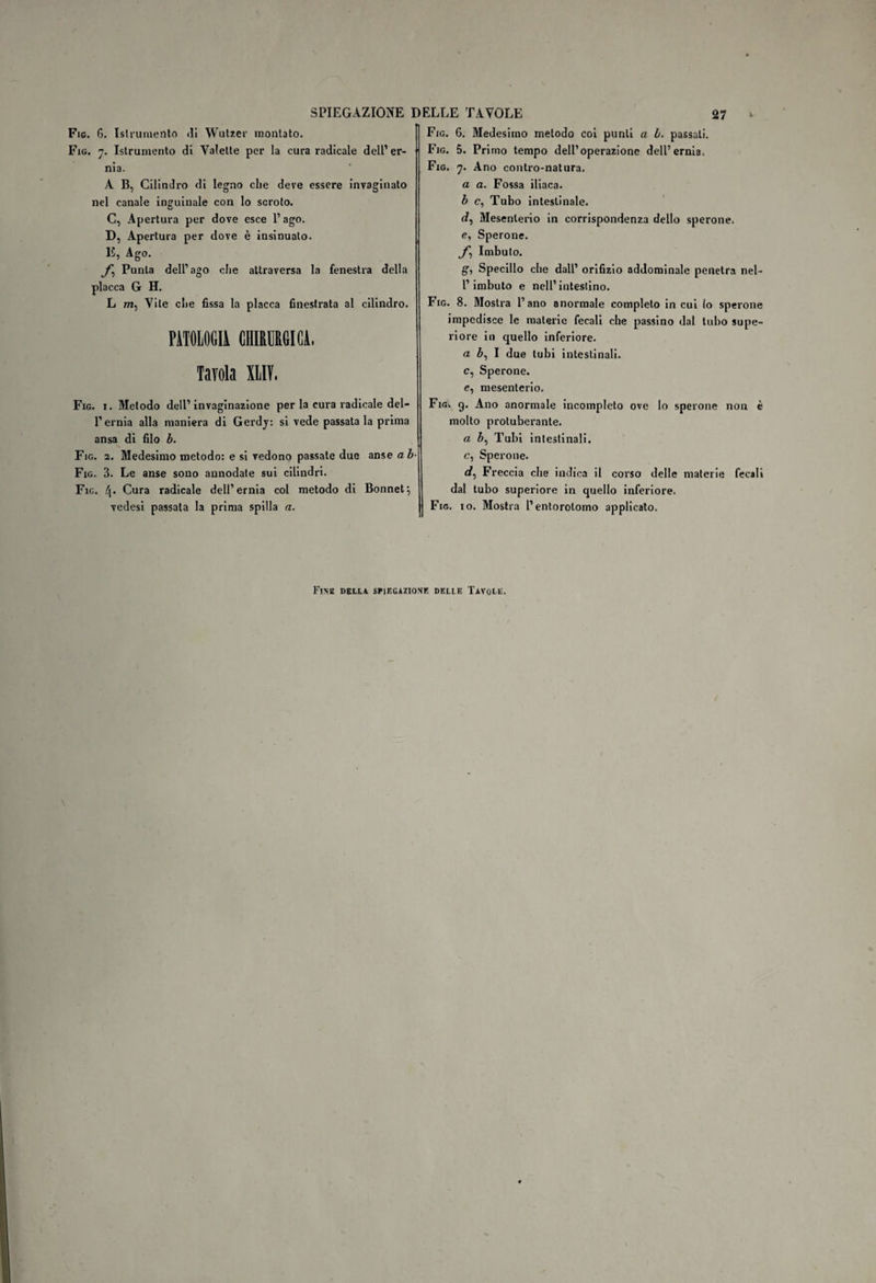 Fio. 6. Linimento ili Wutzer raonlato. Fig. 7. Istrumento di Yalelte per la cura radicale dell’er¬ nia. A B, Cilindro di legno che deve essere invaginato nel canale inguinale con lo scroto. C, Apertura per dove esce l’ago. D, Apertura per dove è insinuato. E, Ago. f,\ Punta dell’ago che attraversa la fenestra della placca G H. L m, Vile die fissa la placca finestrata al cilindro. PÀTOLOGIi CHIRURGICA. Tavola XtlV, Fig. i. Metodo dell’invaginazione per la cura radicale del¬ l’ernia alla maniera di Gerdy: si vede passata la prima ansa di filo b. Fig. 2. Medesimo metodo: e si vedono passate due anse ab- Fig. 3. Le anse sono annodate sui cilindri. Fig. tj. Cura radicale dell’ernia col metodo di Bonnet-, vedesi passala la prima spilla a. Fig. 6. Medesimo metodo coi punti a b. passali. Fig. 5. Primo tempo dell’operazione dell’ernia. Fig. 7. Ano contro-natura. a a. Fossa iliaca. b c, Tubo intestinale. d, Mesenterio in corrispondenza dello sperone. e, Sperone. /, Imbuto. gì Specillo che dall’ orifizio addominale penetra nel- l’imbuto e nell’ intestino. Fig. 8. Mostra l’ano anormale completo in cui (o sperone impedisce le materie fecali che passino dal tubo supe¬ riore in quello inferiore. ab, I due tubi intestinali, c, Sperone, e, mesenterio. Fica g. Ano anormale incompleto ove lo sperone non è molto protuberante. a b, Tubi intestinali. c, Sperone. d, Freccia che indica il corso delle materie fecali dal tubo superiore in quello inferiore. Fig. io. Mostra l’entorolomo applicato. Futa della spiegazione delle Tavole.