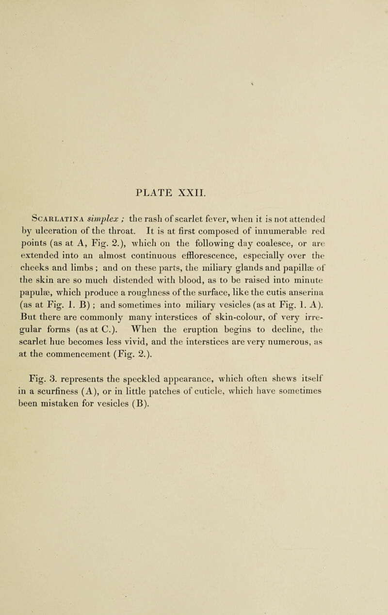 Scarlatina simplex ; the rash of scarlet fever, when it is not attended by ulceration of the throat. It is at first composed of innumerable red points (as at A, Fig. 2.), which on the following day coalesce, or are extended into an almost continuous efflorescence, especially over the cheeks and limbs ; and on these parts, the miliary glands and papillae of the skin are so much distended with blood, as to be raised into minute papulae, which produce a roughness of the surface, like the cutis anserina (as at Fig. 1. B); and sometimes into miliary vesicles (as at Fig. 1. A). But there are commonly many interstices of skin-colour, of very irre¬ gular forms (asatC.). When the eruption begins to decline, the scarlet hue becomes less vivid, and the interstices are very numerous, as at the commencement (Fig. 2.). Fig. 3. represents the speckled appearance, which often shews itself in a scurfiness (A), or in little patches of cuticle, which have sometimes been mistaken for vesicles (B).