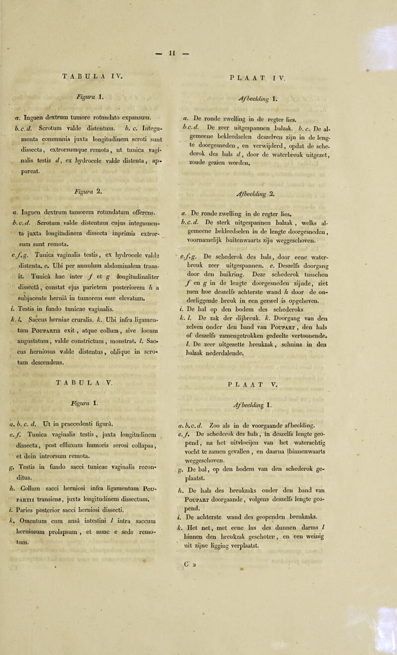 TABULA IV. Figura 1. / «■ a. Inguen dextrum tumore rotnndato expansum. b. c. d. Scrotum ralde distentum. b. c. Int'egu- menta communia juxta longitudinem scroti sunt dissecta, extrorsumque remota, ut tunica vagi¬ nalis testis d, ex hydrocele valde distenta, ap- pareat. Figura 2. a. Inguen dextrum tumorem rotundatum offercns» b. c.d. Scrotum valde distentum cujus integumen- ta juxta longitudinem dissecta inprimis extror- sum sunt remota. e.f.g. Tunica vaginalis testis, ex hydrocele valde distenta. e. Ubi per annulum abdominalem trans¬ it. Tunic& hac inter f et g longitudinaliter dissect;!, constat ejus parietem posteriorem h a subjacente hernia in tumorem esse elevation. i. Testis in fundo tunicae vaginalis. k. 1. Saccus herniae cruralis. k. Ubi infra ligamen- turn Poupartii exit , atque collum, sive locum angustatum, valde constrictum, monstrat. /. Sac¬ cus herniosus valde distentus, oblique in scro¬ tum descendens. TABULA V. Figura 1. a. b. c. d. Ut in praecedenti figura. e.f. Tunica vaginalis testis , juxta longitudinem dissecta, post eftluxum humoris serosi collapsa, et dein introrsum remota. g. Testis in fundo sacci tunicae vaginalis recon- ditus. h. Collum sacci herniosi infra ligamentum Pou¬ partii transiens, juxta longitudinem dissectum. i. Paries posterior sacci herniosi dissecti. k. Omentum cum ansa intestini l inlra saccutn herniosum prolapsum , et nunc e sede remo- turn. P L A A T IV. Af bedding 1. «. De ronde zwelling in de regter lies. b.c.d. De zeer uitgespannen balzak. b.c. De al- gemeene bekleedselen deszelven zijn in de leng- te doorgesneden , en verwijderd, opdat de sche. derok des bals d, door de waterbreuk uitgezet, zoude gezien worden. Afbeelding 2. a. De ronde zwelling in de regter lies. b. c.d. De sterk uitgespannen balzak , welks al- gemeene bekleedselen in de lengte doorgesneden, voornamelijk buitenwaarts zijn weggeschoven. &-fg. De schederok des bals, door eene water¬ breuk zeer uitgespannen. e. Deszelfs doorgang door den buikring. Deze schederok tusschen f en g in de lengte doorgesneden zijnde, ziet men hoe deszelfs achterste wand h door de on- derliggende breuk in een gezwel is opgeheven. i. De bal op den bodem des schederoks k. 1. De zak der dijbreuk. k. Doorgang van den zelven onder den band van Poupart , den bals of deszelfs zamengetrokken gedeelte vertoonende. 1. De zeer uitgezetle breukzak, schuins in den balzak nederdalende. P L A A T V, Afbeelding 1. a. b. c. d. Zoo als in de voorgaande afbeelding. e.f * De schederok des bals, in deszelfs lengte geo- pend, na bet uilvloeijen van bet waterachtig vocht te zamen gevallen , en daarna tbimienwaarts weggeschoven. g. De bal, op den bodem van den schederok ge- plaalst. h. De bals des breukzaks onder den band van Poupart doorgaande, volgens deszelfs lengte geo- pend. i. De achterste wand des geopenden breukzaks. k. Het net, met eene lus des dunnen darms l binnen den breukzak geschoten, en een weinig uit zijne ligging verplaatst.