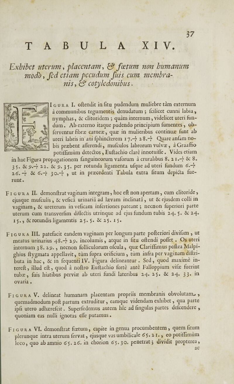 57 Exhibet uterum, placent ani, & foetum non humanum modo, fed etiam pecudum fuis cum membra¬ nis , 0 cotyledonibus. Igura I. offendit in fitu pudendum muliebre tam externum a communibus tegumentis denudatum 3 fcilicet cunni labia, nymphas, Sc clitoridem } quam internum, videlicet uteri fun¬ dum . Ab externo itaque pudendo principium fumentes , ob- ferventurfibra carne#, qu# in mulieribus continu# funt ab uteri labris in ani fphinSterem 17.-7 28.-7 Quare anfam no¬ bis prtebent afferendi, mufculos labrorum vulv#, aGraaffio potiflimum dete&os, Euftachio clare innotuiffe. Vides etiam in hac Figura propagationem fanguineorum vaforum a cruralibus 8. 2 1.-7 Se 8. 3 5. & 9.-7 22. Se 9. 3 5. per rotunda ligamenta ufque ad uteri fundum er.-f 26, -7 Se d.-r 30.-7 > ut praecedenti Tabula extra fitum depi&a fue¬ runt . Figura II. demonftrat vaginam integram, hoc eft non apertam, cum clitoride > ejusque mufculis, Se vefica urinaria ad l#vam inclinata, ut Se ejusdem colli in vaginam, Se ureterum inveficam infertiones pateant, necnon fuperiori parte uterum cum transverfim diffe<5tis utrinque ad ejus fundum tubis 24. 5« Se 24» 15., Se rotundis ligamentis 25.5. Se 25. 15. Figura III. patefacit eandem vaginam per longum parte pofteriori divifam , ut meatus urinarius 48.-7 29. incolumis, atque in fitu offendi poffet . Os uteri internum 38. 29. , necnon folliculorum ofcula, qu# ClarilTimus poftea Malpi- ghius ftygmata appellavit, tum fupra orificium, tum infra per vaginam diftri- buta in hac, Se in fequenti IV. Figura delineantur . Sed, quod maxime in- tereft, illud eft, quod a noftro Euftachio forte ante Falloppium vif# fuerint tub#, fuis hiatibus pervi# ab uteri fundi lateribus 24. 25. Se 24. 33. in ovaria . Figura V. delineat humanam placentam propriis membranis obvolutam^ , quemadmodum poft partum extruditur, eamque videndam exhibet, qua parte ipfi utero adhterefeit. Superfedemus autem hic ad fingulas partes delcendere , quoniam eas nulli ignotas effe putamus. Figura VI. demonftrat foetum, capite in genua procumbentem , quem fitum plerunque intra uterum fervat, ejusque vas umbilicale 65.21., eo potiflimum loco, quo ab amnio 5.16. in chorion 5. 30. penetrat 3 dividit propterea, ac