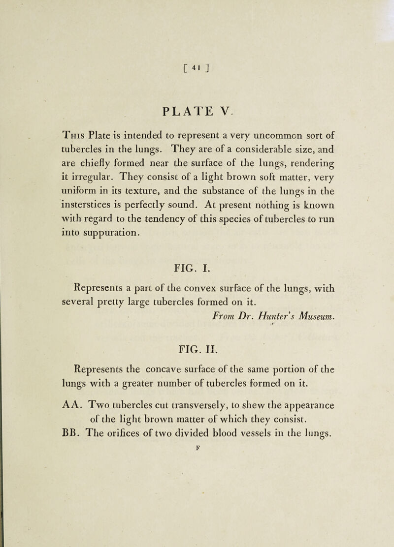 PLATE V This Plate is intended to represent a very uncommon sort of tubercles in the lungs. They are of a considerable size, and are chiefly formed near the surface of the lungs, rendering it irregular. They consist of a light brown soft matter, very uniform in its texture, and the substance of the lungs in the insterstices is perfectly sound. At present nothing is known with regard to the tendency of this species of tubercles to run into suppuration. FIG. I. Represents a part of the convex surface of the lungs, with several pretty large tubercles formed on it. From Dr. Hunter s Museum. FIG. II. Represents the concave surface of the same portion of the lungs with a greater number of tubercles formed on it. A A. Two tubercles cut transversely, to shew the appearance of the light brown matter of which they consist. BB. The orifices of two divided blood vessels in the lungs. F