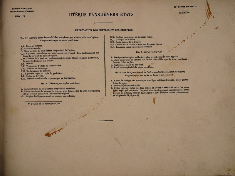 taT Borna a* ntrov., traité pratique DIS MALADIES DE l’UTKRÜâ. (lltw } UTÉRUS DANS DIVERS ÉTATS. V»  ■ —1 PLlKCHE I**- \ EXPLÏCATION DES LETTRES ET DES CHIFFRES- Fie lr*. Utérus à l’état de vacuité chez une femme qui n’avait point eu d'enfant. L’organe est vu par sa paroi postérieure. A. A. Corps de l’utérus. B. Museau de tanche. C. Ligne médiane ou plan fibreux longitudinal de l'utérus. O O. Ligamens postérieurs ou utéro-sacrés provenant d’un prolongement des fibres du corps et du col de l’organe. D D. Ailerons de la matrice ; prolongement des plans fibreux obliques postérieurs, formant les ligamens des ovaires. E, E. Ovaires. F, F. Trompes de Fallope ou tubes utérins. G, G. Pavillon de la trompe. H, H. Bords frangés du pavillon. I, 1. Ligamens larges ou replis du péritoine. J, J. Cordon de l’ovaire. K, K. Portion antérieure du vagin vue par sa face’inteme. Fig. 2. Utérus vu par sa face antérieure. A. Ligne médiane ou plan fibreux longitudinal antérieur* B. Lèvre-antérieure du museau de tanche, plus longue que la leyre postérieure j elle ne permet pas de voir l’orifice utéro-vaginal. C. û. Origine des ligamens ronds ou cordons sus-pubiens. 0,0. Cordons sus-pubiens ou ligamens ronds. D, D. Trompes de Fallope. E, E. Bords frangés de la trompe. F, F. Ovaires vus à travers le tissu des ligamens larges. G, G. Ligamens larges ou replis du péritoine. Fig. 3. Utérus vu de profil. A. Paroi postérieure plus saillante et plus arrondie oup la paroi opposée. B. Lèvre postérieure du museau de tanche plus élevée que la lèvre antérieure, formant le bec de flûte. C. Repli vésico-utérin du péritoine. _ * * D. Repli recto-vaginal de la même memürane. Fig. 4. Vue de la face interne de l’utérus pendant l écoulement des réglés f l'organe ouvert sur un de ses bords et sur son fond. * A. Corps de l’utéÿjjs. On y remarque une ligne médiane déprimée , et des goutte¬ lettes de sang. B. Orifice interne du col utérin. C. Orifice externe. Entre ces deux orifices se trouve la cavité du col et les nom¬ breux replis qui composent l'appareil d’un développement considérable de cetto portion de l’utérus, pendant la grossesse et dans quelques autres circonstances. (Voir planche II, figure 6.) N° d’ordre de la publication, 64.