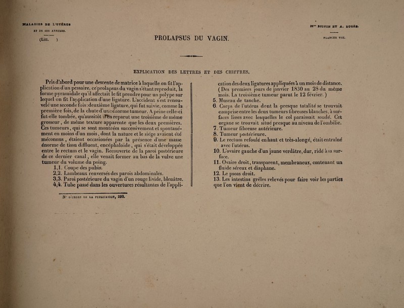 *1 DE SES ÀSNEXEi. M“* BOJVIW ET A. BUGÉ*. (Litt. ) PROLAPSUS DU VAGIN. flàkche viii. •■«goe»- EXPLICATION DES LETTRES ET DES CHIFFRES. Pris d’abord pour une descente de matrice à laquelle on fitl’ap- plicalion d un pcssaire, ce prolapsus du vagin s’étant reproduit, la forme pyramidale cju il affectait le fit prendre pour un polype sur lequel on fit 1 application d une ligature. L’accident s’est renou¬ velé une seconde fois -.deuxième ligature, qui fut suivie, comme la- première fois, de la chute d’une énorme tumeur. A peine celle-ci fut-elle tombée, qu’aussitot îFfen reparut une troisième de même grosseur , de même texture apparente que les deux premières. Ces tumeurs, qui se sont montrées successivement et spontané¬ ment en moins d’un mois, dont la nature et le siège avaient été méconnus , étaient occasionées par la présence d une masse énorme de tissu dififluent, encéphaloïde , qui s était développée entre le rectum et le vagin. Recouverte de la paroi postérieure de ce dernier canal, elle venait former au bas de la vulve une tumeur du volume du poing. 1.1. Coupe des pubis. 2.2. Lambeaux renversés des parois abdominales. 3.3. Paroi postérieure du vagin cl’un rouge livide, bleuâtre. 4.4. Tube passé dans les ouvertures résultantes de l’appli¬ cation des deux ligatures appliquées a un mois de distance. (Des premiers jours de janvier 1830 au 28 du même mois. La troisième tumeur parut le 12 février. ) 5. Museau de tanche. 6. Corps de l’utérus dont la presque totalité se trouvait comprise entre les deux tumeurs fibreuses blanches, à sur¬ faces lisses avec lesquelles le col paraissait soude'. Cet organe se trouvait situé presque au niveau de l’ombilic. 7. Tumeur fibreuse antérieure. 8. Tumeur postérieure. 9. Le rectum refoulé en haut et très-alongé, était entraîné avec l’utérus. 10. L’ovaire gauche d’un jaune verdâtre, dur, ridé à sa sur¬ face. 11. Ovaire droit, transparent, membraneux, contenant un fluide séreux et diaphane. 12. Le psoas droit. 13. Les intestins grêles relevés pour faire voir les parties que L’on vient de décrire.