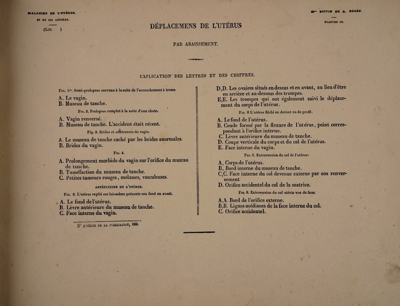 »-■ BOXVIR ET A. DUGfc». * ST DR SES ANNEXES. (Litt. ) DÉPLACEMENS DE L’UTÉRUS PAR ABAISSEMENT. S PLANCHE IX. EXPLICATION’ DES LETTRES / Fig. 1. Semi-prolapsus survenu à la suite de l’accouchement à terme. A. Le vagin. B. Museau de tanche. 4 Fig. 2. Prolapsus complet à la suite d’une chute. A. Vagin renversé. B. Museau de tanche. L’accident était récent. Fig. 3. Brides et adhérences du vagin. A. Le museau de tanche caché par les brides anormales. B. Brides du vagin. Fig. 4. A. Prolongement morbide du vagin sur l’orifice du museau de tanche. B. Tuméfaction du museau de tanche. G. Petites tumeurs rouges, molasses, vasculeuses. ANTÉFLEXION DE i/ütÉRUS. Fig. 6. L’utérus replié sur lui-même présente son fond en avant. A. Le fond de l’utérus. B. Lèvre antérieure du museau de tanche. G. Face interne du vagin. N fi'ftSBRS B* PVSWCAiIOï| 280. ET DES CHIFFRES. D, D. Les ovaires situés en dessus et en avant, au lieudetre en arrière et au-dessous des trompes. E, E. Les trompes qui ont également suivi le déplace¬ ment du corps de l’utérus. Fig. 0.L’utérus fléchi en devant vu de profil. A. Le fond de l’utérus. B. Coude formé par la flexure de l’utérus, point corres¬ pondant a l’orifice interne. C. Lèvre antérieure du museau de tanche. D. Coupe verticale du corps et du col de l’utérus. E. Face interne du vagin. Fig. 7. Extroversion du col de l’utérus: A. Corps de l’utérus. B. Bord interne du museau de tanche. C. C. Face interne du col devenue externe par son renver¬ sement D. Orifice accidentel du col de la matrice. Fig. 8. Extroversion du col utérin vue de face; A, A. Bord de l’orifice externe. B, B. Lignes médianes de la face interne du col. G. Orifice accidentel. y /