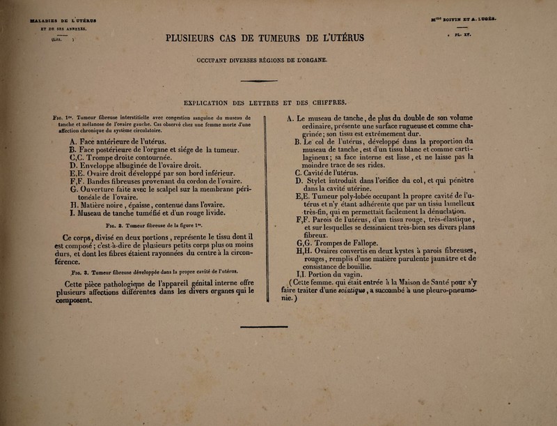 ET DE SES ANWE1ES. Mme BOIVIW ET A. LÜOÈS. PLUSIEURS CAS DE TUMEURS DE L’UTÉRUS OCCUPANT DIVERSES RÉGIONS DE L’ORGANE. EXPLICATION DES LETTRES ET DES CHIFFRES. Fig. lr“. Tumeur fibreuse interstitielle avec congestion sanguine du museau de tanche et mélanose de l’ovaire gauche. Cas observé chez une femme morte d’une affection chronique du système circulatoire. A. Face antérieure de l’utérus. B. Face postérieure de l’organe et siège de la tumeur. C. C. Trompe droite contournée. D. Enveloppe albuginée de l’ovaire droit. E. E. Ovaire droit développé par son bord inférieur. F. F. Bandes fibreuses provenant du cordon de l’ovaire. G. Ouverture faite a\ec le scalpel sur la membrane péri¬ tonéale de l’ovaire. H. Matière noire , épaisse, contenue dans l’ovaire. I. Museau de tanche tuméfié et d’un rouge livide. Fig. 2. Tumeur fibreuse de la figure lre. Ce corps, divisé en deux portions , représente le tissu dont il est composé ; c’est-à-dire de plusieurs petits corps plus ou moins durs, et dont les fibres étaient rayonnées du centre à la circon¬ férence. Fig. 3. Tumeur fibreuse développée dans la propre cavité de l’utérus. Cette pièce pathologique de l’appareil génital interne offre plusieurs affections différentes dans les divers organes qui le composent. A. Le museau de tanche, de plus du double de son volume ordinaire, présente une surface rugueuse et comme cha¬ grinée ; son tissu est extrêmement dur. B, Le col de l’utérus, développé dans la proportion du museau de tanche , est d’un tissu blanc et comme carti¬ lagineux ; sa face interne est lisse , et ne laisse pas la moindre trace de ses rides. C, Cavité de l’utérus. D, Stylet introduit dans l’orifice du col, et qui pénètre dans la cavité utérine. E, E. Tumeur poly-lobée occupant la propre cavité de l’u- térus et n’y étant adhérente que par un tissu lamelleux -très-fin, qui en permettait facilement la dénudation. F, F. Parois de l’utérusrd’un tissu rouge, très-élastique, et sur lesquelles se dessinaient très-bien ses divers plans fibreux. G, G. Trompes de Fallope. H, H. Ovaires convertis en deux kystes à parois fibreuses, rouges, remplis d’une matière purulente jaunâtre et de consistance de bouillie. I, 1. Portion du vagin. ( Celte femme, qui était entrée à la Maison de Santé pour s’y faire traiter d’une sciatique, a succombé à une pieuro-pneumo- nie. )