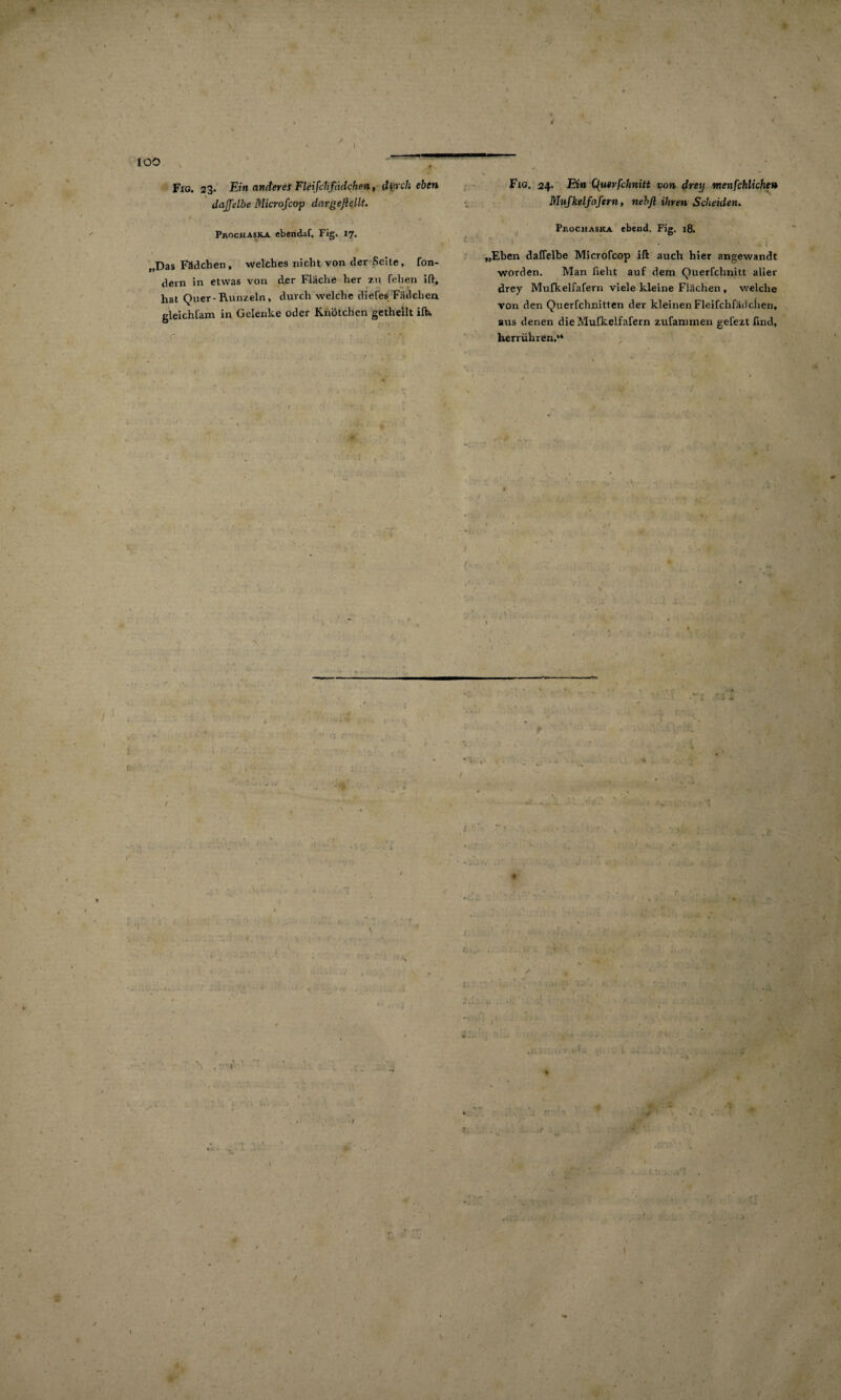 / * I IGO * ' V11 Fig. 23. Ein anderes Fleifchfadchen, dweh eben dajfelbe Microfcop dargeßellt. Prochaska ebendaf. Fig, 17. „Das Fädchen, welches nicht von der Seite, fon- dem in etwas von der Fläche her zu fehen ift, hat Qner-Runzeln, durch welche diefes Fädchen gleichfam in Gelenke oder Knötchen getheilt ilh r ... Fxg. 24. Ein Quer feimitt von dreij wienfchliche» Mufkelfaftrn, nebfl ihren Scheiden. Pr.ocjiASKA ebend, Fig. 18. „Eben daflelbe Microfcop ift auch hier angewandt worden. Man ßeht auf dem Querfchnitt aller drey Mufkelfafern viele kleine Flächen , welche von den Querfchnitten der kleinen Fleifchfädeben, aus denen die Mulkelfafern zufammen gelezt find, herrühren.“ \ X x \ i