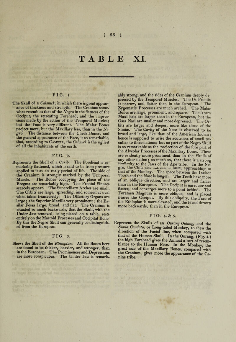 TABLE XI. FIG. l. The Skull of a Calmuck, in which there is great appear¬ ance of thickness and strength. The Cranium some¬ what resembles that of the Negro in the flatness of the Occiput, the retreating Forehead, and the impres¬ sions made by the action of the Temporal Muscles; but the Face is very different. The Malar Bones project more, but the Maxillary less, than in the Ne¬ gro. The distance between the Cheek-Bones, and the general appearance of the Face, is so remarkable, that, according to Camper, the Calmuck is the ugliest of all the inhabitants of the earth. T7TG. 2. Represents the Skull of a Carib. The Forehead is re¬ markably flattened, which is said to be from pressure applied to it at an early period of life. The side of the Cranium is strongly marked by the Temporal Muscle. The Bones occupying the place of the Bregma are remarkably high. The Frontal Sinuses scarcely appear. The Superciliary Arches are small. The Orbits are large, spreading, and somewhat oval when taken transversely. The Olfactory Organs are large; the Superior Maxilla very prominent; the Ba¬ silar Fossa large, broad, and flat. The Cranium is situated so much backwards, that the Skull, with the Under Jaw removed, being placed on a table, rests entirely on the Mastoid Processes and Occipital Bone. By this the Negro Skull can generally be distinguish¬ ed from the European. FIG. 3. Shews the Skull of the 'Ethiopian. All the Bones here are found to be thicker, heavier, and stronger, than in the European. The Prominences and Depressions are more conspicuous. The Under Jaw is remark¬ ably strong, and the sides of the Cranium deeply de¬ pressed by the Temporal Muscles. The Os Frontis is narrow, and flatter than in the European. The Zygomatic Processes are much arched. The Malar Bones are large, prominent, and square. The Antra Maxillaria are larger than in the European, but the Ossa Nasi are smaller and more depressed. The Or¬ bits are larger and deeper, more like those of the Simiae. The Cavity of the Nose is observed to be broad and large, like that of the American Indian; hence is supposed to arise the acuteness of smell pe¬ culiar to these nations; but no part of the Negro Skull is so remarkable as the projection of the fore part of the Alveolar Processes of the Maxillary Bones. These are evidently more prominent than in the Skulls of any other nation; so much so, that there is a strong similarity to the Jaws of the Ape tribe. In the Ne¬ gro, the Chin ain^ roticata a little, approaching to that of the Monkey. The space between the Incisor Teeth and the Nose is longer. The Teeth have more of an oblique direction, and are larger and firmer than in the European. The Occiput is narrower and flatter, and converges more to a point behind. The Foramen Magnum is more oblique, and is placed nearer the Occiput. By this obliquity, the Face of the Ethiopian is more elevated, and the Head thrown more backwards, than in the European. FIG. 4.Sc 5. Represent the Skulls of an Ourang-Outang, and the Simia Caudata, or Long-tailed Monkey, to shew the direction of the Facial line, when compared with that of the Human Skull. In the Ourang, (Fig. 4.) the high Forehead gives the Animal a sort of resem¬ blance to the Human Face. In the Monkey, the great size of the Maxillary Bones, compared with the Cranium, gives more the appearance of the Ca¬ nine tribe.