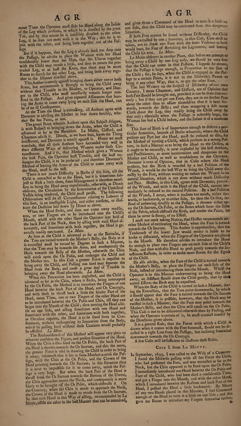 mean Time the Operator muft Aide his Hand along theTnMe of the Leg which prefers to to the other Toe, and by tins means he is infallibly dnetted to t ^ ^ Leg, if he does not meet with it in the y, p p_ jo£ with the other, and bring both together out of the Pal £'gBu« if it happens, that .he I* « ^ the Paffage, he advifes to place < W together confiderably lower to return the pro- with the Child may recede^ h«l=,e and ^ ^ Room to fcuSi for the other Leg, and bring both away toge- ther in thethofos'utterlyagainft bringing down either one or both Arl^ £cnydsSit ftrongly to bring the Child away . , ’ , . trouble to the Mother, or Operator, and Dan without that Trouble ^ ^ |er ,t0 h, Paffage And gives repeated Affurances that leav- fng tile Arn^ m come away lying on each Side the Head, can ^At^Ttoe^teHetd is extraaing, all Authors agree with Deventer in advifing the Mother to bear down forcibly, whe- thThegrand Point Vherein Authors upon this Subjeift difagree, to bringing down the Arms, when the Child 13 ,S,W d iffer as the Shoulders. La Motte, Giffard, and advanced as fa _. . as we have feen, leaves the Thing Mifoent; and Dfve«ris utterly againft it.’ Hence we mult indifferent, Authors have fucceeded very well in their different Ways of delivering Women under theft Cir- their ditterent y Method which gives a Woman lead Trouble, and the leaft en¬ dangers the Child, is to be preferred ; and therefore Deventer s Me*od of leaving the Arms of the Child to come away with thCTtee is”of mueff Difficulty in Births of .this Sort, till the Child is extrafted as far as the Head, but‘t‘s fometimes fifo- jea to flick a little there, feme Management is therefmen fary to bring the Head away expedmoufly, otherwtfe, as JJ on , / .1® pirmlation bv the Intervention of the Umbilical Veffelsbeing hindered, the Child muft perilh. The following Obfervations will fet all Circumftances relating to Labours o an intelligible Light and either confirm, or illuf- trate the Dodrine laid down by Dioms as above. ‘menThe Head flicks, and does not comeim; nne or two Fingers are to be introduced into the Childs Mouth whilft with the other Hand the Operator lays hold of the back Part of the Neck, then by afling w,th ,eac£i !'' ternately, and fometimes with both together, the Head ge jierally readily extricated. La Motte. R„ttncks if As foon as the Child is advanced as far as the Buttocks, it the Toes are turned towards the Mother’s Bellybthe Bodyas^it is extraaed muft be turned by Degrees in “ that the Toes may be towards the Anus, and confequentlythe Heels towards the Belly of the Mother the Ch,„ will catch upon the Os Pubis, and endanger the Child and the Mother too. in this Cafe a greater Force is requ.f.te to bring away the Child, and Pulling too hard may feparatethe Head from the Body, and caufe a great deal of Trouble m bringing away the Head afterwards. La Motte. When this Precaution has been negle&ed, and the Chi advanced as far as the Chin, where it flicks, being inter“Pt^ by the Os Pubis, the Method is to introduce the Fingers of one Hand betwixt the back Part of the Head, and Os Coccygis, and with thefe to thruft back a little the hinder Part of the Head mean Time, one or two Fingers of the other Hand are £be introduced betwixt the Os Pubis and Chin till they can begot into the Mouth of the Child ; then turning the Headl alit- tle&cn one Side, and afting fometimes with one Hand and fometimes with the other, and fometimes with both together, as Occafion requires, the Head is to be freed from its Con¬ finement, without endangering its Separation from the 5 which by pulling hard without thefe Cautions would probably be effected. La Motte. , . The Reafonablenefs of this Method will appear v^ry P1^11 whoever confiders the Figure, and prefent Situation of the tod When the Chin is thus fixed on the Os Pubis, the back Pa the Head is thrown towards the Os Sacrum, and this the more, the oreater Force is ufed in drawing the Child in order to bring it away, infomuch that it lies in fome Meafure a-crofs the Pai- fafre with the Chin at the Os Pubis, and the Crown of the Head pointing towards the Os Sacrum; in this Situation then it is next to impoflible for it to come away, unlefs the Pai- fage is very large. But when the back Part of the Head is thruft from the Os Sacrum towards the Bottom of the Uterus, ti Ch n approaches nearer the Neck, and confequently is more likely to be brought off the Os Pubis, which obftrufis it On the Contrary, when the Chin is made to approach the Neck, the Crown of the Head is made to recede from the Os Sacrum. So that each Hand in this Way of afting, recommended by La Motte, affifts the other in the beft Manner that can be conceived. A G R and gives them a Command of the Head to turn it a little on. one Side, that the Child may he extricated from this dangerous If both Feet cannot be found without Difficulty, the Child may be ext rafted by one ; however, in this Cafe, Care muft be taken not to draw one Foot with the fame \ imence as both would bear, for Fear of ftretcliing the Ligaments, and laming the Child for ever. La Motte. I a Motte obferves in another Place, that before we attempt to bring away a Child by one Leg only we fhould be very litre that the Child can come in that Pollute, I fuppofe he means, that the Paffage is large enough, Proportion to the Size of the Child ; for, he fays, when the Child is engaged ,n the Paf¬ fage to a certain Point, it is not ... the Midwife s Power to brine it any other Way, that is, to get the other Foot. The late Writers on the Subjea of M.dwifry of our own Country, I mean Chapman, and Giffard, are of Opinion that both Feet Ihould be brought out, provided it can be done conveni¬ ently ; but if they can get one Foot, they are in no farther Pam about the other than to affirm themfelves that it is bent for¬ wards, towards the Belly; and then wrapping a foft warm Cloth about the Leg, they readily bring the Child away by that only; efpecially when the Paffiage is tolerably large, the Woman has had a Child before, and the Infant is of a moderate This Sort of Birth is of Importance enough to deferve a par- ticular Attention, becaufe all Births whatever, where the Child prefents any Part but the Head, muft be reduced to this, for the Method of turning a Child, which prefents in a wrong Pof- ture, in fuch a Manner as to bring the Head to the Orifice, as it ought to be naturally, is now exploded by the beft Authors, and Praaitioners, as more inconvenient and dangerous to thd Mother and Child, as well as troublefome to the Operator. Deventer is even of Opinion, that in Cafes where the Head, prefents, but the Birth is retarded by a bad Pofition of the Womb, it would be the beft Way to bring the Child away di- reaiy by the Feet, without waiting to reduce the Womb to its natural Situation, which is not done without much Difficulty and Pain. Heifter, in this Cafe, agrees with Deventer, provid¬ ed the Womb, and with it the Head of the Child, cannot im¬ mediately be reduced to the natural Pofition. By a bad Pofition of the Womb, I mean, when it inclines too much, either for¬ wards, or backwards, or to either Side, for then the Orifice, in- ftead of anfwering diredlly to the Paffage, is thrown either up¬ on the Os Sacrum, Os Pubis, or the Bones which form the Sides of the Pelvis, which obftrudl the Birth, and render the Pains, let them be never fo ftrong, of no Effect. I muft not omit taking Notice, that Heifter recommends an¬ other Method of extricating the Head, when the Face is turned towards the Os Sacrum. This Author is apprehenfive, that the Tendernefs of the lower Jaw would render it liable to be broke or diflocated, when the Fingers of the Operator are placed in the Mouth. He therefore advifes to introduce the Hand far enough to place two Fingers one on each Side of the Child 4 Nofe and then with this Hand to prefs gently towards the In- teftinum Re£tum, in order to make more Room for the Egrets of the Child. . . , He alfo advifes, when the Face of the Child is turned towards the Mother’s Belly, to place the Fingers on each Side of the Nofe, inftead of introducing them into the Mouth. vVhilfc th@ Operator is in this Manner endeavouring to bring the Hea away, an Afliftant fhould draw the Child gently, that by theft united Efforts the Birth may be expedited. When the Body of the Child is turned in fuch a Manner, dur¬ ing the Extraaion, that the Toes point downwards, by which it fhould appear that the Face is turned towards the Os Sacrum of the Mother, it is poffible, however, that the Neck may be twifted in fuch a Manner, that the Face may point towards the Mother’s Belly, and then the Chin will catch on the Os Pubis. This Cafe is not to be difeovered otherwife than by Feeling, and when the Operator is certain of it, he muft condua himfelf by the Direaions given above. . . It is a general Rule, that the Force with which a Child is drawn when it comes with the Feet foremoft, fhould not be di- reaed in a right Line from the Paffage, but inclining fomewhat. downwards towards the Os Coccygis. A few Cafes will befufficient to illuftrate thefe Rules. Case I. from La Motte. In September, 1693, I was called to the Wife of a Carp«rtff- I found the Midwife pulling with all her Force t e > who had prefented the Feet, and was extraaed as ar a Neck, but the Chin appeared to be fixed upon the Us Pu • I immediately introduced one Hand betwixt the s u . Face of the Child, who had been dead a considerable 1 > and got a Finger into the Mouth, and wit t e otie » which I introduced betwixt the Reaum and back Pa Head, I pufhed the Head a little backwards. BjJto of my two Hands placed in this Manner, I had Com ^ enough of the Head to turn it a little on one Side’ ‘ A[ . gave me Room to introduce my Fingers fomewhat a ^