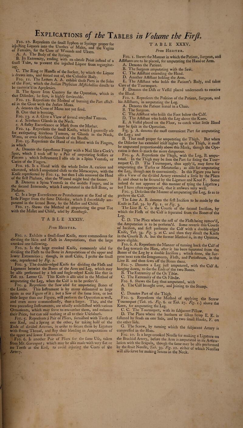 jijipimiipmpiji . . ,FIC- '°: ReprefentJ the finall Syphon or Syringe proper for meamg Liquors into the Urethra of Males, and the Vagina ol P emales, for the Cure of Wounds and Ulcers. A. A. The Body of the Syringe. B. Its Extremity, ending with an obtufe Point inftead of a fmall I ube, to prevent the injected Liquor from regurgitat¬ es The Ring or Handle of the Sucker, by which the Liquor is drawn into, and forced out of, the Cylindric Body Fig. n. The Letters A. A. exhibit thole Parts in the Soles of the Feet which the ltahan Phyfician Mijiicbellim direits to be cauteriz’d in Apoplexies. nThe/4lT .C?utery for.the Operation, which in that Diforder, he fays, is highly ferviceable. Fig; 12. Reprefents the Method of burning the Part affeft- ed in the Gout with the Indian Moxa. A. denotes the Cone of Moxa not yet fired. B. One that is burning. FlCT £3; f* 9've a View Several eneyfted Tumors. c. d. Scirrhous Glands in the Neck. e. A flefhy Excrefcence or Mark from the Mother Fig. 14. Reprefents the fmall Knife, which I generally ufe for extirpating feirrhous Tumors, or Glands in the Neck Wens, or even feirrhous Glands of the Breafts. . Fig. I5* Reprefents the Hand of an Infant with fix Finders in which D ’ A. Denotes the fuperfluous Finger with a Nail like a Cock’s opur, which I took off by a Pair of amputating ScilTors or Pincers ; which Instrument I alfo ufe in a Spina Ventofa, or Caries of the Fingers. Rig. 16. Is a Hand with the whole Index A. carious and ulcerated, which I amputated clofe to the Metacarpus, with the Knife reprefented by Fig. 14. but then I alfo removed the Head of the firft Phalanx, that the Wound might heal the fooner. B. Denotes a Spina Ventofa in the middle Finger, and in the fecond Internode, which I amputated in the firft Bone, or Phalanx. C. Is a large Excrefcence or Protuberance at the End of the little Finger from the fame Diforder, which I fuccefsfully am¬ putated in the fecond Bone, by the Mallet and Chifel. Fig. 17. Shews the Method of amputating the great Toe with the Mallet and Chifel, ufed by Roonhuyfe. TABLE XXXIV. From Heister. Fig. 1. Exhibits a fmall-fized Knife, more commodious for dividing the Skin and Flefh in Amputations, than the large crooked one following. Fig. 2. Is the large crooked Knife, commonly ufed for dividing the Flefh to the Bone in Amputations of the upper and lower Extremities ; though, in moft Cafes, I prefer the fmall one, reprefented by Fig. 1. Fig. 3. The double-edged Knife for dividing the Flefh and Ligament betwixt the Bones of the Arm and Leg, which may be alfo performed by a lefs and fingle-edged Knife like that in Fab. 22. Letter G. This Knife is alfo ufed in the Method of amputating the Leg, when the Calf is to be preferv’d. the Limbs. This Inftrument is by many delineated as again as our Figure of it ; but a Saw of the fame Size, or but little larger than our Figure, will perform the Operation as well, and even more commodioufly, than a larger. This, and the two preceding Inftruments, are ufually embellifhed with various Ornaments, which may ferve to encumber them, and enhance their Price, but can add nothing at all to their Ulefulnefs. Fig. 5. Reprefents a Pair of Pliers, furnifhed with Teeth at one End, and a Spring at the other, for large taking hold w»v ..> .n- °f the Ends of divided Arteries, in order to fecurc them by Ligature with ftrong Thread, and flop their bleeding in Amputations of the upper and lower Extremities. Fig. 6. Is another Pair of Pliers for the fame Ufe, taken from Mr. Garengeot; which may be alio made with very flat or no Teeth at the End, to avoid injuring the Coats of tire Artery. 1 TABLE XXXV. From Heister. Fig. 1. Shews the Manner in which the Patient, Surgeon, and Afliftants are to be placed, for amputating the Hand or Arm. A. Denotes the Patient. B. The Surgeon amputating with the Saw. C. The Afliftant extending the Hand. D. Another Afliftant holding the Arm. E. The Afliftant who holds the Patient’s Body, and takes Care of the Tournequet. F. Denotes the Diflr or Veil'd placed underneath to receive the Blood. Pig. 2. Reprefents the Pofition of the Patient, Surgeon, and his Afliftants, in amputating the Leg. A. Denotes the Patient feated in a Chair. B. The Surgeon. C. The Afliftant who holds the Foot below the Calf. D. The Afliftant who holds the Leg above the Knee. E. A Veffel placed on the Floor, to catch what little Blood may be fpilt in the Operation. Fig. 3. A. denotes the moft convenient Part for amputating the Leg ; and B. J hat moft proper for amputating the Thigh. But when the Diforder has extended itfelf higher up in the Thigh, it muft be amputated proportionably above this Mark, though the Ope¬ ration is then fo much the more dangerous. Fig. 4. A. Reprefents the Thigh, with the Leg, B. ampu¬ tated. In the Thigh may be feen the Part for fixing the Tour¬ nequet C. D. The Tournequet, thus apply’d, may ferve for amputating the Tarfus or Metatarfus ; as alfo for amputating the Leg, though not fo conveniently. In this Figure you have alfo a V iew of the divided Artery extended a little by the Pliers E. and about to be fecured by the Ligature and Knot F. Some indeed do not approve of this manner of tying the Ligature ; but I have often experienced, that it anfwers very well. Pig. 5. Defcribes the Manner of amputating the Leg, fo as to preferve the Calf. r The Line A. B. denotes the firft Incifion to be made by the Knife in Fab. 34. by Fig. 1. or Fig. 3. 1 he Line B. C. is the Courfe of the fecond Incifion, by which the Flefti of the Calf is feparated from the Bones of the Leg. C. D. The Place where the reft of the Flefh being remov’d, the Amputation is to be perform’d. Some reverie this Courfe of Incifion, and firft perforate the Calf with a double-edged Knife, Fab. 34. Fig. 3. at C. and then they direct the Knife in the Courfe B. A. but the former Method is, in my Opinion, more eligible. Fig. 6. A. Reprefents the Manner of turning back the Calf of the Leg towards the Ham, after it has been feparated from the Bones of the Leg by a double Incifion ; which done, the Sur¬ geon next cuts the Integuments, Flefh, and Periofteum, in the Line B. and then faws off the Bones there. Fig. 7. Denotes a Leg juft amputated, wdth the Calf A. hanging down, to fee the Ends of the two Bones. B. The Extremity of the Os Tibiae. C. The Extremity of the Os Fibulae. Fig. 8. Shews the Leg thus amputated, with B. C. Denotes Part of the Thigh. Fig. 9. Reprefents the Method of applying the Screw Tournequet (Fab. 26. Fig. 6. or Fab. 27. Fig. i.j above the Knee, for amputating the Leg. C. C. The Tournequet, with its fubjacent Pillow. D. The Place where the leathern or filken Strop E. E. is faftened by Studs on one Side, and by two fmall Hooks, F. on the other Side. G. The Screw, by turning which the fubjacent Artery is compreffed in the Ham. J Fig. 10. Is a large crooked Needle for making a Ligature on the Brachial Artery, before the Arm is amputated in its Articu¬ lation with the Scapula, though the fame may be alfo performed by the ftrait Needle, 39. Fig. 12. either of which Needles will alfo lerve for making Setons in the Neck.