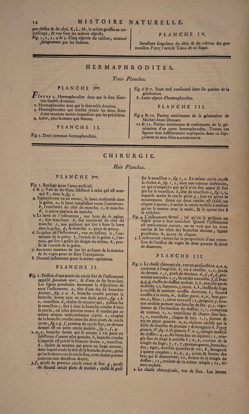 par-defTus 8c de coté. K, L, M, la même groflîe au mi- crofcope, & vue fous les memes afpetfts. Fig. i,i , 3 > 4 & f. Cinq efpeces du caillou, nommé Jàlagramam par les Indiens. PLANCHE IV. Striiélurc finguliere du tibia 8c du cubitus des gre¬ nouilles. Voyei l'article Tibia de ce Suppl. \ HERMAPHRODITES. Trois Planches. PLANCHE I«*. FIo y re i. Hermaphrodite dans qui le fexe fémi- nin femble dominer. 2. Hermaphrodite dans qui le fexe mâle domine. 3. Hermaphrodite qui femble réunir les deux fexes d’une maniéré moins imparfaite que les précédens. 4. Autre, plus homme que femme. PLANCHE II. Fig. f. Deux jumeaux hermaphrodites. Fig. 6 8c 7. Sujet mal conformé dans fês parties de la génération. 8. Autre efpece d’hermaphrodite. PLANCHE III. Fig. 9 8c 10. Parties extérieures de la génération de Michel-Anne Drouart. 11 & 11. Parties intérieures 8c extérieures de la gé¬ nération d’un autre hermaphrodite. Toutes ces figures font fuffifàmment expliquées dans ce Supz plémeru au mot Hermaphrodite. CHIRURGIE. Huit Planches. PLANCHE I«e; Fig. 1. Bandage pour l’anus artificiel. 2 & j^Vafè de fer-blanc fubftitué à celui qui eft mar¬ qué B , dans la fig. 1. 4. Saphyletome vu en entier, fa lame renfermée dans la gaine, a, la lame rempliffant toute l’ouverture. b, l’extrémité du côté du manche, r, le manche. d, la partie applatie du manche. f. La lame de 1 infiniment, vue hors de fa gaine. a, fon tranchant, b, fon extrémité du côté du manche, c, une paillette qui fert à fixer la lame dans la gaine, d, le manche, e, piece de pouce. 6. La gaine de l’inftrument, vue en-deflous. a , l’ou¬ verture de la gaine, b, l’entrée de la gaîne. c, l’an¬ neau qui fert à pafïer les doigts du milieu. A, pro¬ fil de l’entrée de la gaîne. 7. Ancienne maniéré de lier les polypes de la matrice & du vagin pour en faire l’extirpation. 8. Nouvel infiniment pour la même opération. PLANCHE II. fig- 1 . Deflein d’une partie du cercle fixe de l’inftrument appellé fpeculum uteri , & d’une de fes branches. Les lignes pon&uées montrent la difpofiiion de tout l’inftrument. a, tête d’une des fix branches droites,2 a. b, branche courbe portant la branche droite unie en une feule piece,fig. 1 b. c, tourillon, d, chaîne de montre qui, pafiant fur le tourillon c, fert à tirer la branche courbe b vers le cercle , où elles doivent toutes fe rendre par ce même moyen uniformément répété, e, couplet delà branche courbe entre les deux joues du cercle creux, fig. 2 g. jf, portion du cercle fixe, au-devant duquel efi un autre cercle mobile ,fig. 3,/, g. 2.. a, u, branche droite qui fe monte à vis pour en fubftituer d’autres plus grandes. bt branche courbe à laquelle eft jointe la branche droite, c, tourillon. d9 chaîne de montre qui porte un large anneau, dans lequel roule la tête de la branche droite, pour qu’en la tirant vers le cercle fixe, cette chaîne prenne toujours une direction droite. 3./, profil du premier cercle creux 8c fixe, g, profil du fécond cercle plein & mobile, ajufié & pofé fur le tourillon c9fig. 1,2. Le même cercle reçoit la chaîne d,fig. 1,2, dans une rainure intérieure, ce qui n’empêche pas qu’il n’ait fon appui 8c fon jeu fur le tourillon, ht tete du tourillon c,fig. 1, 2, laquelle arrête le cercle plein g , fans en gêner le mouvement. Entre ces deux cercles eft établi un cliquet à queue -, il arrête le cercle mobile à mefure qu on le tourne avec la main, 8c la queue fert à le relâcher. Fig. 4. L’inftrument^ fermé , tel qu’on le préfente an vagin pour y être introduit. Quand l’inftrument eft entierement^ouvert, on ne voit que les deux ceiclés 8c les tetes des branches droites , lignes ponéhiées. b, queue du cliquet, f. L infiniment ouvert fur la proportion d’une exten- !on,. orifice du vagin de deux pouces & demi de diamètre. PLANCHE III. 1 . ' i>-i- r .3 HCilpcucive. a. a, a roulettes a 1 angloife. b, vis à oreilles, c, c pied: de devant, c, c, pieds de derrière. d, d, d ,d pre¬ mières traverfes. e, e, fécondés traverfès. /' //bras c ^ . s/u doflîer mobile, h, h, marche-pied1 mobi es. v, fupports.y, tiroir, k, k, chaflis du fiege a couhfle & premier couffin dormant. /, feconc couflinalamain.™, doflîer garni. n,n, bras gar¬ nis. o, fléau i 1, talon renverfé 5 2 , poignée, n, bou ton mobile portant une broche de fer. a /régu¬ lateurs de 1 inclinaifon du doflîer. r, r, crampons de retenue, j', j, tourillons 8c chapes fans lacs, s, s, tourillons , chapes 8c lacs. t,t, écrous Si fnen4P!fCe-MUajrée* U’ Uy r<^îtres cachés parla faJhe de douilles du portant 7 & bougeoir 8. Voye* flanche V.fig. 6. o- planche V.u. 3 , tringle mobile du doflîer, 4,4, fes branches en équerre ; s, trin¬ gle fixe du fiege a couhfle kj 6,6, coulans de la tringle du fiege; 7, 7, 7, portons garnis, branche, dez, tiges, douilles quarrées & vis ; 8, bougeoir a quatre couplets 53,3,3, joints & frettes des bras qui fe démontent ; 10, boîtes de la tringle du doflîer j 11, coulant de la même tringle j 12, tê- tiere mobile. * i.La chaife chirurgicale, vue de face. Les lettres