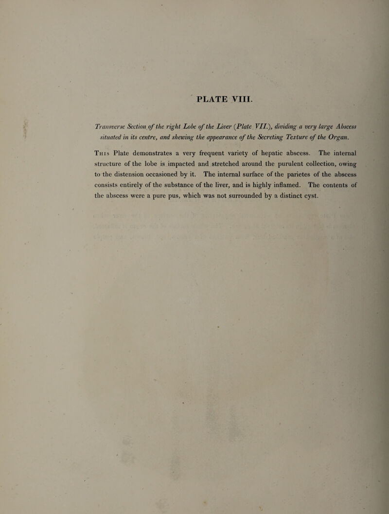 Transverse Section of the right Lobe of the Liver {Plate VII.), dividing a very large Abscess situated in its centre, and shewing the appearance of the Secreting Texture of the Organ. This Plate demonstrates a very frequent variety of hepatic abscess. The internal structure of the lobe is impacted and stretched around the purulent collection, owing to the distension occasioned by it. The internal surface of the parietes of the abscess consists entirely of the substance of the liver, and is highly inflamed. The contents of the abscess were a pure pus, which was not surrounded by a distinct cyst.