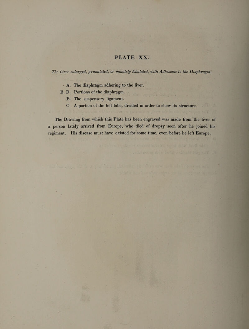 The Liver enlarged, granulated, or minutely lobulated, with Adhesions to the Diaphragm. * A. The diaphragm adhering to the liver. B. D. Portions of the diaphragm. E. The suspensory ligament, C. A portion of the left lobe, divided in order to shew its structure. The Drawing from which this Plate has been engraved was made from the liver of a person lately arrived from Europe, who died of dropsy soon after he joined his regiment. His disease must have existed for some time, even before he left Europe.