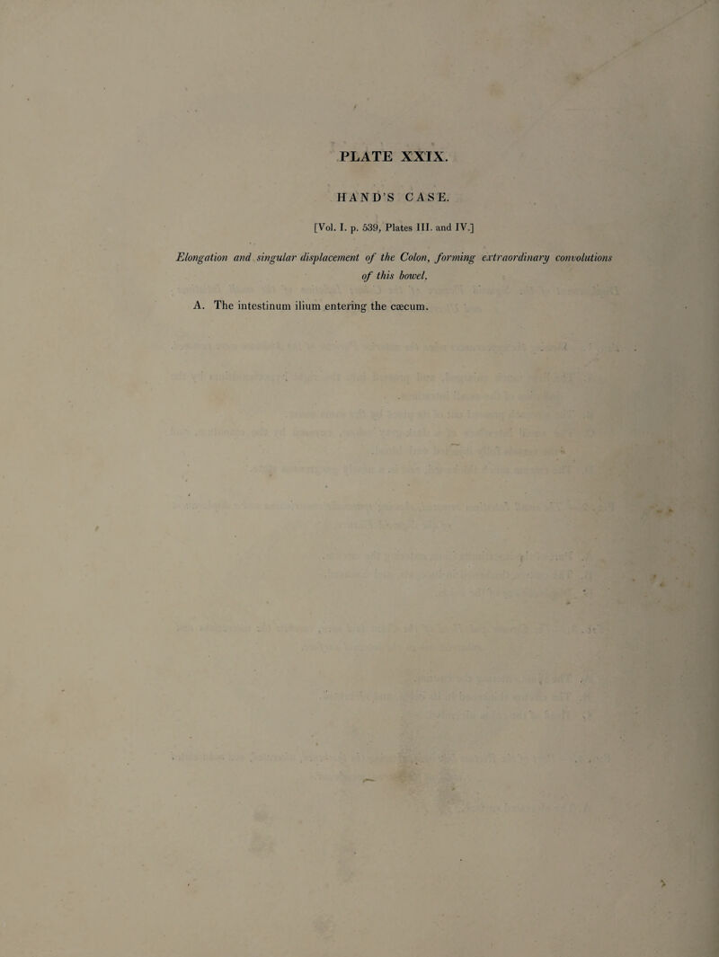 f ? . ... . t , PLATE XXIX. V 1 ( % HAND’S CASE. [Vol. I. p. 539, Plates III. and IV.] Elongation and singular displacement of the Colon, forming extraordinary convolutions of this bowel. A. The intestinum ilium entering the caecum. i t >