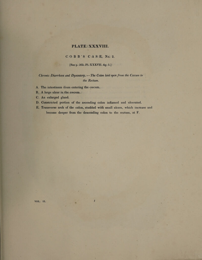 COBB’S CASE, No. 2. [See p. 363. PI. XXXVII. fig. 1.] Chronic Diarrhoea and Dysentery. —The Colon laid open from the Coe cum to the Rectum. A. The intestinum ilium entering the caecum. B. A large ulcer in the caecum. C. An enlarged gland. D. Constricted portion of the ascending colon inflamed and ulcerated. E. Transverse arch of the colon, studded with small ulcers, which increase and become deeper from the descending colon to the rectum, at F. VOL. II. t