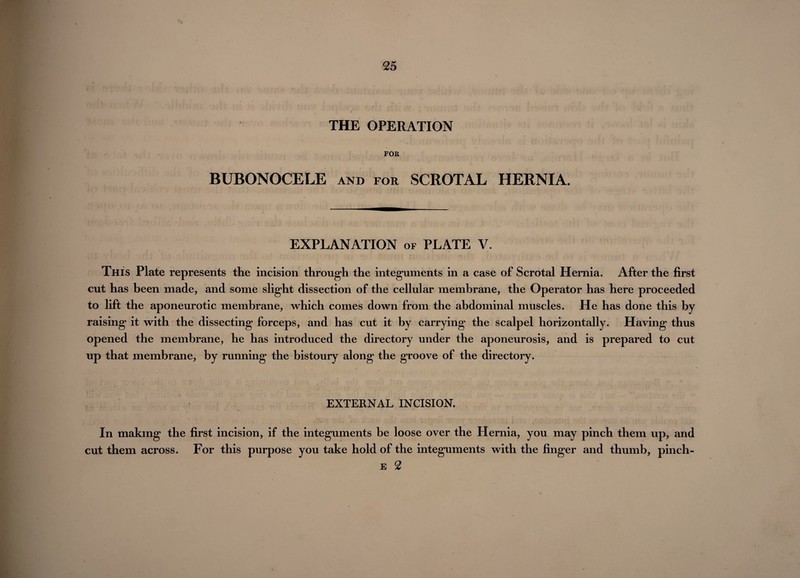 THE OPERATION FOR BUBONOCELE and for SCROTAL HERNIA. EXPLANATION of PLATE V. This Plate represents the incision through the integuments in a case of Scrotal Hernia. After the first cut has been made, and some slight dissection of the cellular membrane, the Operator has here proceeded to lift the aponeurotic membrane, which comes down from the abdominal muscles. He has done this by raising it with the dissecting forceps, and has cut it by carrying the scalpel horizontally. Having thus opened the membrane, he has introduced the directory under the aponeurosis, and is prepared to cut up that membrane, by running the bistoury along the groove of the directory. EXTERNAL INCISION. In making the first incision, if the integuments be loose over the Hernia, you may pinch them up, and cut them across. For this purpose you take hold of the integuments with the finger and thumb, pinch - e 2
