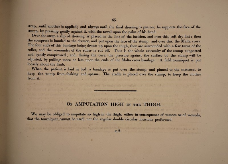 strap, until another is applied; and always until the final dressing* is put on, he supports the face of the stump, by pressing gently against it, with the towel upon the palm of his hand. Over the strap a slip of dressing is placed in the line of the incision, and over this, soft dry lint; then the compress is handed to the dresser, and put upon the face of the stump, and over this, the Malta cross. The four ends of this bandage being drawn up upon the thigh, they are surrounded with a few turns of the roller, and the remainder of the roller is cut off. Thus is the whole extremity of the stump supported and gently compressed; and, during the cure, the pressure against the surface of the stump will be acyusted, by pulling more or less upon the ends of the Malta cross bandage. A field tourniquet is put loosely about the limb. When the patient is laid in bed, a bandage is put over the stump, and pinned to the mattress, to keep the stump from shaking and spasm. The cradle is placed over the stump, to keep the clothes from it. Of AMPUTATION HIGH in the THIGH. * T ~ '* ' ' * ' ? ^ > • •>  'V I v-< - jr--* , .... ...v *■ ' ' * *■ - . ‘ * J- • .. , - \ > 4*’ *■ < • 9 » I We may be obliged to amputate so high in the thigh, either in consequence of tumors or of wounds, that the tourniquet cannot be used, nor the regular double circular incisions performed. k 2 *