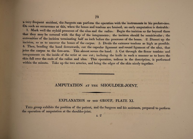 a very frequent accident, the Surgeon can perform the operation with the instruments in his pocket-case. On such an occurrence as this, when the bones and tendons are bruised, an early amputation is desirable. 1. Mark well the styloid processes of the ulna and the radius. Begin the incision so far beyond these that they may be covered with the flap of the integuments; the incision should be semicircular; the extremities of the incision terminating half an inch before the processes of the bones. 2. Dissect up the incision, so as to uncover the bones of the carpus. 3. Divide the extensor tendons as high as possible. 4. Then, bending the hand downwards, cut the capsular ligament and round ligament of the ulna, that joins the carpus to the fore-arm. This almost severs the hand. 5. Cut through the flexor tendons and integuments on the inside of the wrist at one cut; inclining the knife in such a manner as to leave the skin full over the ends of the radius and ulna. This operation, tedious in the description, is performed within the minute. Take up the two arteries, and bring the edges of the skin nicely together. AMPUTATION at the SHOULDER-JOINT. EXPLANATION of the GROUP, PLATE XI. This group exhibits the position of the patient, and the Surgeon and his assistants, prepared to perform the operation of amputation at the shoulder-joint. h 2