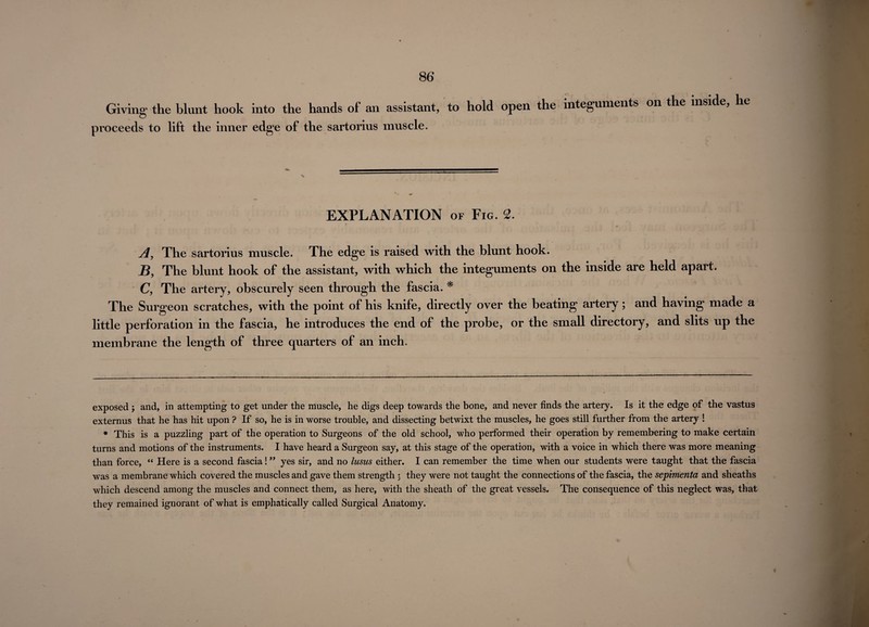 Giving the blunt hook into the hands ol an assistant, to hold open the integuments on the inside, proceeds to lift the inner edge of the sartorius muscle. EXPLANATION of Fig. 2. A, The sartorius muscle. The edge is raised with the blunt hook. B, The blunt hook of the assistant, with which the integuments on the inside are held apart, C, The artery, obscurely seen through the fascia. * * The Surgeon scratches, with the point of his knife, directly over the beating artery; and having made a little perforation in the fascia, he introduces the end of the probe, or the small directory, and slits up the membrane the length of three quarters of an inch. exposed ; and, in attempting to get under the muscle, he digs deep towards the bone, and never finds the artery. Is it the edge of the vastus externus that he has hit upon ? If so, he is in worse trouble, and dissecting betwixt the muscles, he goes still further from the artery ! * This is a puzzling part of the operation to Surgeons of the old school, who performed their operation by remembering to make certain turns and motions of the instruments. I have heard a Surgeon say, at this stage of the operation, with a voice in which there was more meaning than force, “ Here is a second fascia! ” yes sir, and no lusus either. I can remember the time when our students were taught that the fascia was a membrane which covered the muscles and gave them strength : they were not taught the connections of the fascia, the sepimenta and sheaths which descend among the muscles and connect them, as here, with the sheath of the great vessels. The consequence of this neglect was, that they remained ignorant of what is emphatically called Surgical Anatomy.