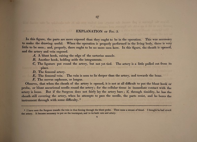 8? EXPLANATION of Fig. 3. In this figure, the parts are more exposed than they ought to be in the operation. This was necessary to make the drawing useful. When the operation is properly performed in the living body, there is very little to be seen; and, properly, there ought to be no more seen here. In this figure, the sheath is opened, and the artery and vein exposed. A, A blunt hook, raising the edge of the sartorius muscle. JB, Another hook, holding aside the integuments. C, The ligature put round the artery, but not yet tied. The artery is a little pulled out from its place. D, The femoral artery. E, The femoral vein. The vein is seen to lie deeper than the artery, and towards the bone. F\ The nervus saphenus, or longus. Observe, that when the sheath of the artery is opened, it is not at all difficult to put the blunt hook or probe, or blunt aneurismal needle round the artery; for the cellular tissue in immediate contact with the artery is loose. But if the Surgeon does not fairly lay the artery bare ; if, through timidity, he has the sheath still covering the artery, when he attempts to pass the needle, the parts resist, and he bores the instrument through with some difficulty. * * I have seen the Surgeon transfix the vein in thus forcing through the blunt probe. Then came a stream of blood, the artery. It became necessary to put on the tourniquet, and to tie both vein and artery. N I thought he had struck