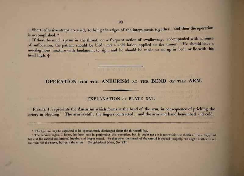 \ Short adhesive straps are used, to bring the edges of the integuments together; and then the opei ation is accomplished. * If there be much spasm in the throat, or a frequent action of swallowing*, accompanied with a sense of suffocation, the patient should be bled, and a cold lotion applied to the tumor. He should have a mucilaginous mixture with laudanum, to sip ; and he should be made to sit up in bed, or lie with his head high. -p OPERATION FOR THE ANEURISM at the BEND of the ARM. EXPLANATION of PLATE XVI. a Figure 1. represents the Aneurism which forms at the bend of the arm, in consequence of pricking the rtery in bleeding. The arm is stiff; the fingers contracted ; and the arm and hand benumbed and cold. * The ligature may be expected to be spontaneously discharged about the thirteenth day. t The nervous vagus, I know, has been seen in performing this operation, but it ought not; it is not within the sheath of the artery, but betwixt the carotid and internal jugular, and deeper seated. So that when the sheath of the carotid is opened properly, we ought neither to see the vein nor the nerve, but only the artery. See Additional Notes, No. XII.