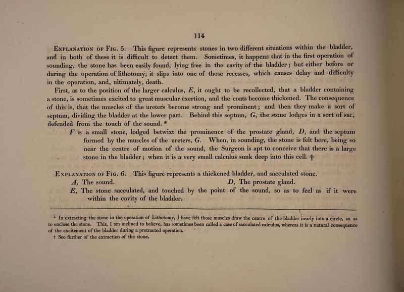 Explanation of Fig. 5. This figure represents stones in two different situations within the bladder, and in both of these it is difficult to detect them. Sometimes, it happens that in the first operation of sounding, the stone has been easily found, lying free in the cavity of the bladder; but either before or during the operation of lithotomy, it slips into one of those recesses, which causes delay and difficulty in the operation, and, ultimately, death. First, as to the position of the larger calculus, E, it ought to be recollected, that a bladder containing a stone, is sometimes excited to great muscular exertion, and the coats become thickened. The consequence of this is, that the muscles of the ureters become strong and prominent; and then they make a sort of septum, dividing the bladder at the lower part. Behind this septum, G, the stone lodges in a sort of sac, defended from the touch of the sound. * * . __ » F is a small stone, lodged betwixt the prominence of the prostate gland, D, and the septum formed by the muscles of the ureters, G. When, in sounding, the stone is felt here, being so near the centre of motion of the sound, the Surgeon is apt to conceive that there is a large stone in the bladder; when it is a very small calculus sunk deep into this cell. ^ Explanation of Fig. 6. This figure represents a thickened bladder, and sacculated stone. A, The sound. D, The prostate gland. E, The stone sacculated, and touched by the point of the sound, so as to feel as if it were within the cavity of the bladder. < . * In extracting the stone in the operation of Lithotomy, I have felt those muscles draw the centre of the bladder nearly into a circle, so as to enclose the stone. This, I am inclined to believe, has sometimes been called a case of sacculated calculus, whereas it is a natural consequence of the excitement of the bladder during a protracted operation, t See further of the extraction of the stone.