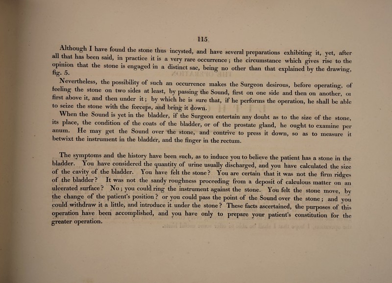 11 have found the stone thus incysted, and have several preparations exhibiting it, yet, after a at as een said, in practice it is a very rare occurrence ; the circumstance which gives rise to the opimon that the stone is engaged in a distinct sac, being no other than that explained by the drawing, Nevertheless, the possibility of such an occurrence makes the Surgeon desirous, before operating, of reeling the stone on two sides at least, by passing the Sound, first on one side and then on another, 01 hrst above it, and then under it; by which he is sure that, if he performs the operation, he shall be able to seize the stone with the forceps, and bring it down. When the Sound is yet in the bladder, if the Surgeon entertain any doubt as to the size of the stone, its place, the condition of the coats of the bladder, or of the prostate gland, he ought to examine per anum. He may get the Sound over the stone, and contrive to press it down, so as to measure it betwixt the instrument in the bladder, and the finger in the rectum. The symptoms and the history have been such, as to induce you to believe the patient has a stone in the bladder. You have considered the quantity of urine usually discharged, and you have calculated the size of the cavity of the bladder. You have felt the stone? You are certain that it was not the firm ridges of the bladder? It was not the sandy roughness proceeding from a deposit of calculous matter on an ulcerated surface ? No ; you could ring the instrument against the stone. You felt the stone move, bv the change of the patient’s position ? or you could pass the point of the Sound over the stone ; and you could withdraw it a little, and introduce it under the stone ? These facts ascertained, the purposes of this operation have been accomplished, and you have only to prepare your patient’s constitution for the greater operation.