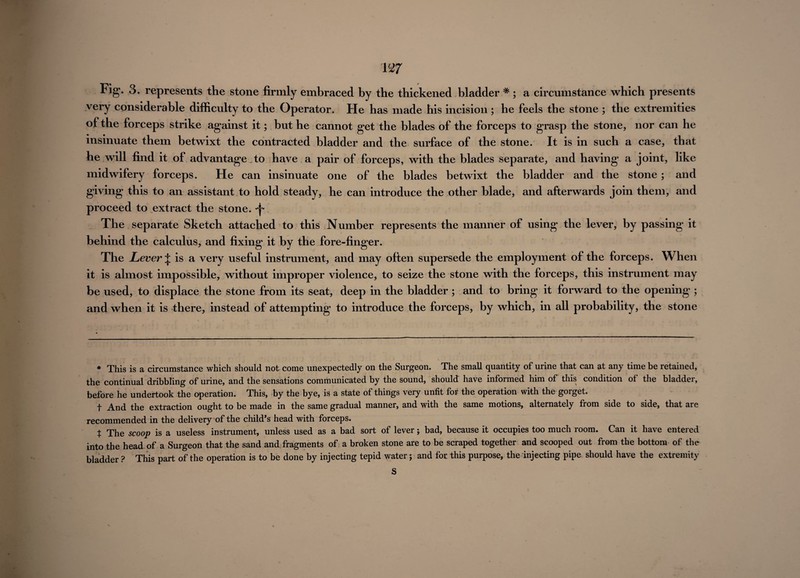 w Fig. 3. represents the stone firmly embraced by the thickened bladder * ; a circumstance which presents very considerable difficulty to the Operator. He has made his incision ; he feels the stone ; the extremities of the forceps strike against it; but he cannot get the blades of the forceps to grasp the stone, nor can he insinuate them betwixt the contracted bladder and the surface of the stone. It is in such a case, that he will find it of advantage.to have a pair of forceps, with the blades separate, and having a joint, like midwifery forceps. He can insinuate one of the blades betwixt the bladder and the stone; and giving this to an assistant to hold steady, he can introduce the other blade, and afterwards join them, and proceed to extract the stone. The separate Sketch attached to this Number represents the manner of using the lever, by passing it behind the calculus, and fixing it by the fore-finger. The Lever ^ is a very useful instrument, and may often supersede the employment of the forceps. When it is almost impossible, without improper violence, to seize the stone with the forceps, this instrument may be used, to displace the stone from its seat, deep in the bladder; and to bring it forward to the opening ; and when it is there, instead of attempting to introduce the forceps, by which, in all probability, the stone * This is a circumstance which should not come unexpectedly on the Surgeon. The small quantity of urine that can at any time be retained, the continual dribbling of urine, and the sensations communicated by the sound, should have informed him of this condition of the bladder, before he undertook the operation. This, by the bye, is a state of things very unfit for the operation with the gorget. •j* And the extraction ought to be made in the same gradual manner, and with the same motions, alternately from side to side, that aie recommended in the delivery of the child’s head with forceps. t The scoop is a useless instrument, unless used as a bad sort of lever j bad, because it occupies too much room. Can it have entered into the head of a Surgeon that the sand and fragments of a broken stone are to be scraped together and scooped out from the bottom of the bladder ? This part of the operation is to be done by injecting tepid water; and for this purpose, the injecting pipe should have the extremity S