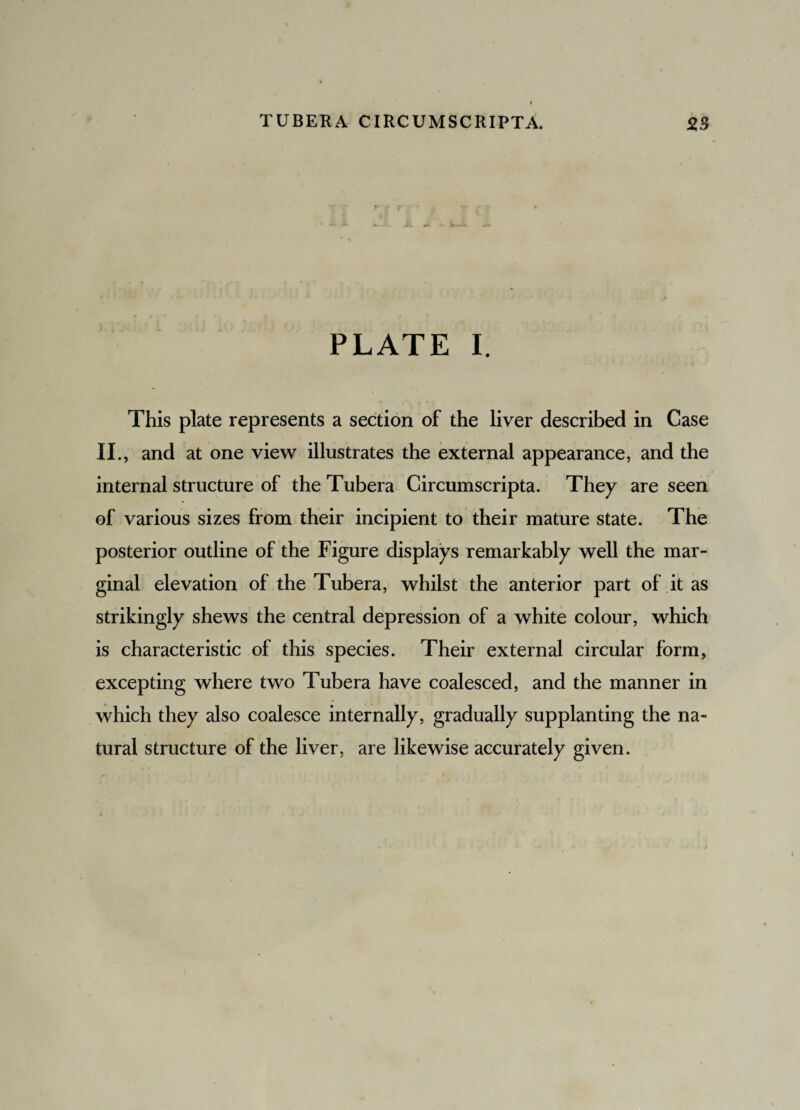 TUBERA CIRCUMSCRIPTA. 25 PLATE I. This plate represents a section of the liver described in Case II., and at one view illustrates the external appearance, and the internal structure of the Tubera Circumscripta. They are seen of various sizes from their incipient to their mature state. The posterior outline of the Figure displays remarkably well the mar¬ ginal elevation of the Tubera, whilst the anterior part of it as strikingly shews the central depression of a white colour, which is characteristic of this species. Their external circular form, excepting where two Tubera have coalesced, and the manner in which they also coalesce internally, gradually supplanting the na¬ tural structure of the liver, are likewise accurately given.