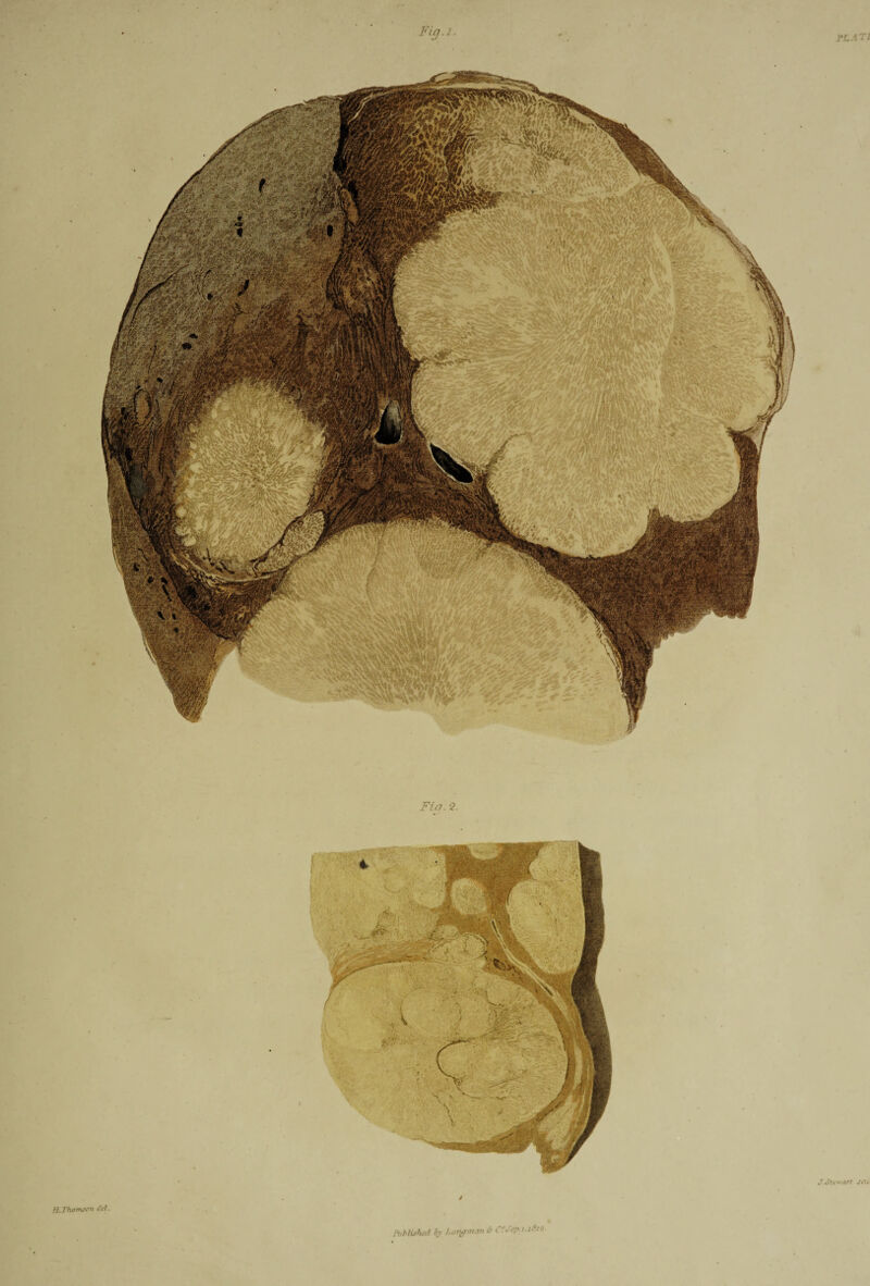 Fin. 2. J. Sti wart Jilt • / H.Thomsen del. Mlished by Longman *• CL rp i-i^1*