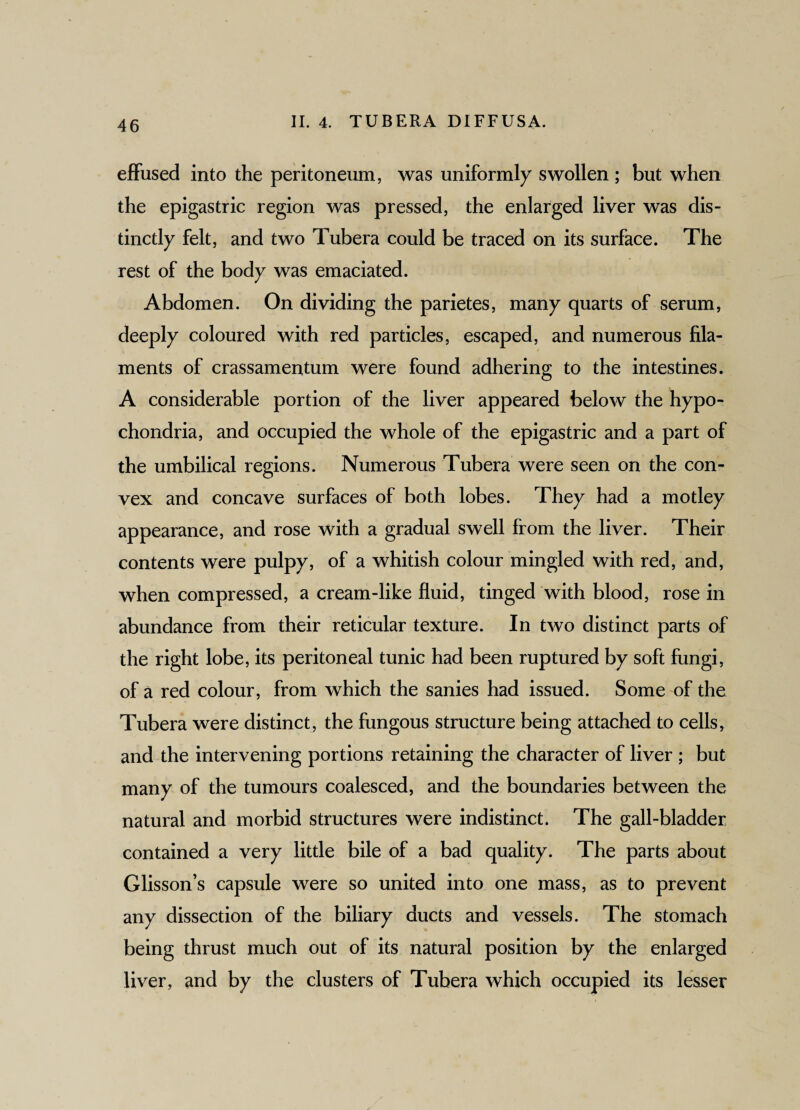 effused into the peritoneum, was uniformly swollen ; but when the epigastric region was pressed, the enlarged liver was dis¬ tinctly felt, and two Tubera could be traced on its surface. The rest of the body was emaciated. Abdomen. On dividing the parietes, many quarts of serum, deeply coloured with red particles, escaped, and numerous fila¬ ments of crassamentum were found adhering to the intestines. A considerable portion of the liver appeared below the hypo¬ chondria, and occupied the whole of the epigastric and a part of the umbilical regions. Numerous Tubera were seen on the con¬ vex and concave surfaces of both lobes. They had a motley appearance, and rose with a gradual swell from the liver. Their contents were pulpy, of a whitish colour mingled with red, and, when compressed, a cream-like fluid, tinged with blood, rose in abundance from their reticular texture. In two distinct parts of the right lobe, its peritoneal tunic had been ruptured by soft fungi, of a red colour, from which the sanies had issued. Some of the Tubera were distinct, the fungous structure being attached to cells, and the intervening portions retaining the character of liver ; but many of the tumours coalesced, and the boundaries between the natural and morbid structures were indistinct. The gall-bladder contained a very little bile of a bad quality. The parts about Glisson’s capsule were so united into one mass, as to prevent any dissection of the biliary ducts and vessels. The stomach being thrust much out of its natural position by the enlarged liver, and by the clusters of Tubera which occupied its lesser