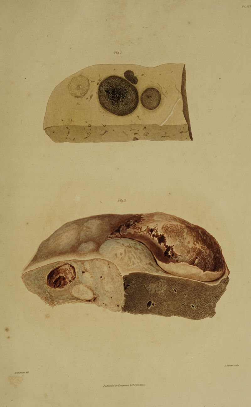 n..rn Fig /• Fig.2. lUllunnson del. J..*lorart JOtlfi. MUshed bvlonaman Sr C?Feb. 1.18J4.