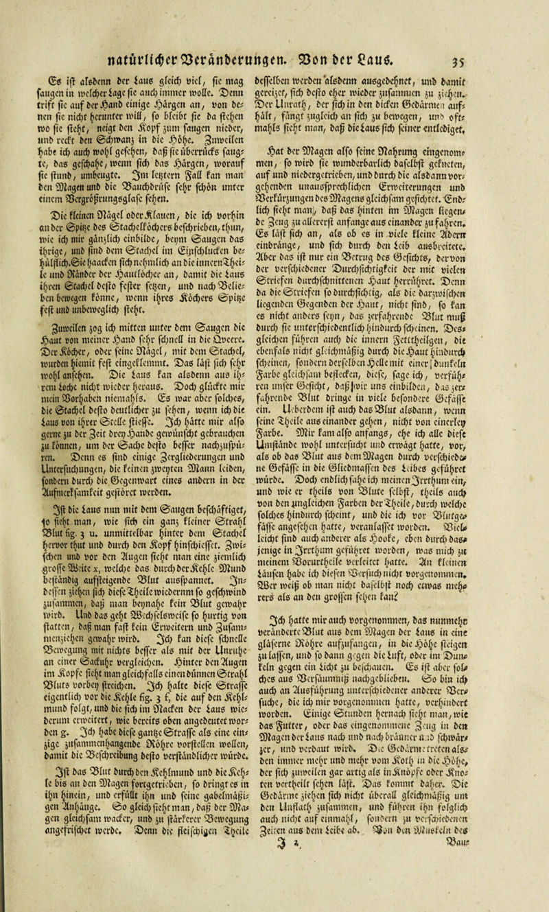 ©g iß alsbenn ber laug gfcirf? t&gt;icf, ftc mag fangen tu welcher lageße and? immer moßc. $)enn triff fic auf berdpanb einige Margen an, »on bc; nen fic nid)t herunter miß, fo bfeibt fie ba fielen wo fie jte^f/ neigt ben Äopf jum fangen nieber, unb reeft ben ©d)t»anj in bic £6hc. ^nwctlcn habe td) auch t»ofß gßchen, baß fic übcrrücfß fang; te, baß gcfcbaßc/ wenn (ich baß bärgen, worauf ßcßuitb, umbeugte. 3nt Intern §aß fan man ben Klagen unb bic 5Baud)brüfe fcf)r feßbu unter einem Sßcraroßrungggiafc fefien. 3)ic Heilten Olägel ober Miauen, bic ich »orhin etttber &lt;3ptBc beß ©tad)eif6d)crßbcfd)rieben,thun, wie id) mir gättßid) cinbilbe, bepnt ©äugen baß ihrige, unb fittb bem ©facbei im ©ijtfdßucfcn be? h»lßtcf)»©ichaacfctt ftcbnebmiid) an bic inncrn^ci; le unb Dvänbcr ber Jpautfod)cr an, bamit bic bauß ihren ©fad)dbcßo fcjler feigen, unb nadjSxite; ben bewegen fbnnc, wenn ifjrcß Äod)crs ©pißc feß unb unbeweglich ßeßf. Zuweilen jog id? mitten unter bent ©äugen bic #aut »on meiner £aub fchr fd)ttcll in bic Q»cerc. ©er ^oeber, ober feine Sftägel, mit bem ©tachcl, mürben ^iemit feft cingeHcmmf. £)ag läßt ßd) fe§r wohl anfe^en. 2&gt;ic laug fan alsbemt auß ijj; rem loche nid)t micbcr ^erauß. S&gt;od) glücftc mir mein Borhabcn niema^fß. ©ß mar aber fold)cß, bie ©tachcl beffo bcutlicher $u feben, wenn ich bic laus »on ihrer ©teile ßteßc. 3$ hatte mir alfo gerne ju ber 3«t brepJ)anbe gemünßht gcbraud&gt;cn $u fontten, um ber ©ad?c beßo beßer nachjufpü; ren. '£&gt;cmt eg fittb einige ^^giteberungen unb Untcrfitd)ungett, bic feinen jmcptcu COIann leiben, fonbern burd) bie ©egenwart eines anbern in bet 2tufmerffamfeit geftorct merben. 3ß bic laug nun mit bem ©äugen befchäftiget, ^0 ßelß man, mie fid) ein gan, Heiner ©trafd 523Iut fig. g u. unmittelbar ^tntcc bem @fad)cl her»or tbut unb burd? ben Äopf hmfehießet. ^wi; fd&gt;en unb vor ben Gingen fte^t man eine jiemlid) große Sßicitc x, mcld)e baß burd) ber Äch^ 20?unb bcßänbig aufßctgenbe 33luf außfpannet. 3n? beßett jie^cn fid) biefc^^cilc wicöcrnm fo gcfchwtnb jufammen, baß man beinahe fein Sölut gewahr mirb. Unb baß geht £Bcd)fclß»octfc fo hurtig »on flatten, baß man faß fein (Erweitern unb gufant; menjiehen gewahr mirb. 3$ ^an biefe fdjncßc ^Bewegung mit nichts beffer alß mit ber Unruhe an einer ©acfuljr »ergleiehcn. Jötntcr ben klugen im Äopfc fleht man gleichfalls einen bannen ©trahl SBlttts »orbet? flrcid)cn. 3$ ha^c btefe ©fräße cigcntüd) »or bie Ächte fig. 3 f, bic auf ben Ächf; munb folgt, unb bic fid) im Olacfen ber laug mtc; herum ermeitert, wie beretfß oben angebcutetmor; ben g* 3d) habe btefe gan^c©traffc afß eine ein# jige jtifantmenhangcnbe £R6hrc »orffeßen moßen, bannt bic Q5cfd)rcibung befio »crffdnbltd)cr mürbe. 3fl baß QMttf burdjbcnÄehlntunb unb bicÄeh; le biß an ben Klagen fortgefrieben, fo bringt cß in ihn hinein, unb erfüllt ihn unb feine gabeimdfjt; gen Anhänge. ©0 glcid) ficht man, baff ber 9}?a; gen glcid)fam maefer, unb jtt frdrfcrcr Bewegung angcfrifd)ct mcrbc. S)enn bie flcijci)igcu ^hc‘le beffetben merben alßbcnn außgcbchnef, unb bamit gcreiicf, fid) befio eher micbcr $ufammcn ju jie^ett. S)cr Unrath, ber fid)in ben biefen ©ebdrmea auf; hält, fängt ytgleid) an fid) ju bauegen, unb oft; mahlß ficht man, baff bie iauß fid) feiner cntlcbigct, Jpaf ber SÖiagcn alfo feine Siahrmtg chtgenomf men, fo mirb fie munberbarfid) bafclbfi gefneten, auf unb niebergetricben, unb burd) bic alßbannuor; gchcttbcn unaußfpred)fid)cn ©rmcitcrungen unb ^Berfurjungcn bee Diiagcnß glcicfifant gefid)tet. ©nbr lief) ficht man;, baff baß hinten im 9J?agen liegen* bc 3'mg juaßcrerfi anfangcaußcinanba- ju fahren, ©ß läfi fid) an, alß ob cg in niete Heine 2fbcrrr cinbränge, unb fid) burd) ben leib auebretfete. 3lbcr baß ifi nur ein betrug beß ®cftd)tß, bemon ber »crfd)icbencr S)urd)fid)rigfcit ber mit tuelcn ©triefen burd)fd)nittencn Jpauf berrührct. 3)enn ba bic ©triefen foburefifiahtig, a£ß bic barjmifdKn liegenben ©egenben ber 4?aut, nicht finb, fo fan es nicht anberß fepn, baß jcrfaljrcnbc 5Blut mu^ burd) ftc unfcrfd)icbenttid)hinburd)fd)ctnen. S)eß? gleiten führen auch bic innern gctttheilgen, bic cbcnfalß nicht gleichmäßig burch bic Jpaut hinburch fd)eincn, fonbern bcrfelkn^cßemit einerfbunfel« garbe glcichfant beficcfcn, biefe, fagcich, »erfüh* ren itnfcr ©eßehf, baß Jwir uns einbdbcn, baßjcr* fahrenbe Q5iitt bringe in viele befonberc ©efäffe ein. Uvbcrbcm iß auch baß Sölut alßbann, wenn feine ^heilc attß einanber gehen, nicht »on einerlei; $«rbe. £0?ir famalfo anfangg, che id) aßc biefe Umßänbe mohl untcrfud)t unb erwägt hafte, »or, alß ob bao auß bcmSOlagcn burd) »crfd)icb(* ne ©efäffe in bic ©licbmaffen beß icibeß gefuhret mürbe. £)od) enblid) fa^c id) meinen3r»thum ein, unb wie er theifß »on 5Btute fcfoß, t/jctls auch »on bennngletchen $ar6cn ber'^hcile,burd) mcld)c fold)Cß hinburd) feheint, unb bie td) »or S)utfge&lt;» fäffe angcfchcn hatte, »eranlafjcf worben. ^Bicß» leicht ftnb auchanbcrer aiß Jpoof'c, eben burd) baß# jenige in 3»»thum gefuhret worben, maß mich ,5« meinem ?BorurfhcUe »crlcitct hatte. 3fn flciuen Käufen habe id) biefen S5erfttd)ttid)t »orgenommen. flßcr weiß ob man nicht bafelbß noch etwas meh# rerS aiß an ben groffen fc^cn fan? 3d) hafte mir auch »orgenommen, baß nmtmehe »eränbcrtcQ5iuf auß bem Klagen ber $attß in eine gläferne Oiohrc aufjufangen, in bie dpö^c ßeigett 51t laßen, unb fo bann gegen bic luft, ober tra Duit* fein gegen ein Iid)t ju befchaucn. ©ß iß aber fob* d)Cß auß SOerfättmniß nad)gcbiiebeu. ©0 bin id; auch an 2lusfüJ)rung unterfchiebcner anberer 33er# fuchc, bte ich mir »orgenommen haWc/ »crhiHbcrf morben. ©tntge ©tauben hernad) ficht man, mie baß$ufter, ober baß eingenommene gntg in bc» Klagen ber Iauß nach unb nach bräuner U;ib fchmär/ jer, tmb »erbaut mirb. ©cbärmetretenals^ beit immer mehr unb mehr öom Äot'h tu Mc ber fich jumciien gar arttgaiß inÄttopfc ober Ätto; fett »erteilt fc^cn läß. X)aß fommt baba:. ®ie ©cbärtne jtehen (id) nid)t überafl gicid)mäßig um ben Unßath jufammen, unb führen ihn foigüd) aud) nid)t auf cinmahl/ fonbern ju »ctfehiebeneit feitest auß bem leibe ab. 3gon ben iVfuofeln bcs i Oku-?