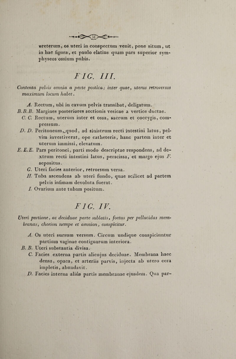 ••••«♦* f) ureterum, os uteri in conspectum venit, pone situm, ut in hac figura, et paulo elatius quam pars superior sym- physeos ossium pubis. F1C. III. Contenta pelvis omnia a parte postica; inter quae, uterus retroversus maximum locum habet. A. Rectum, ubi in cavum pelvis transibat, deligatum. B.B.B. Margines posteriores sectionis vesicae a vertice ductae. C. C. Rectum, uterum inter et ossa, sacrum et coccygis, com¬ pressum. D. D. Peritoneum^quod, ad sinistrum recti intestini latus, pel¬ vim investiverat, ope catheteris, hanc partem inter et uterum immissi, elevatum. E. E. E. Pars peritonei, parti modo descriptae respondens, ad de¬ xtrum recti intestini latus, perscissa, et margo ejus F. sepositus. Q. Uteri facies anterior, retrorsum versa. //. Tuba ascendens ab uteri fundo, quae scilicet ad partem pelvis infimam devoluta fuerat. I. Ovarium ante tubam positum. FIC. IV. Uteri portione, ac deciduae parte sublatis, foetus per pellucidas mem¬ branas, chorion nempe et amnion, conspicitur. A. Os uteri sursum versum. Circum undique conspiciuntur partium vaginae contiguarum interiora. B. B. Uteri substantia divisa. C. Facies externa partis alicujus deciduae. Membrana haec densa, opaca, et arteriis parvis, injecta ab utero cera impletis, abundavit. D. Facies interna alius partis membranae ejusdem. Qua par-