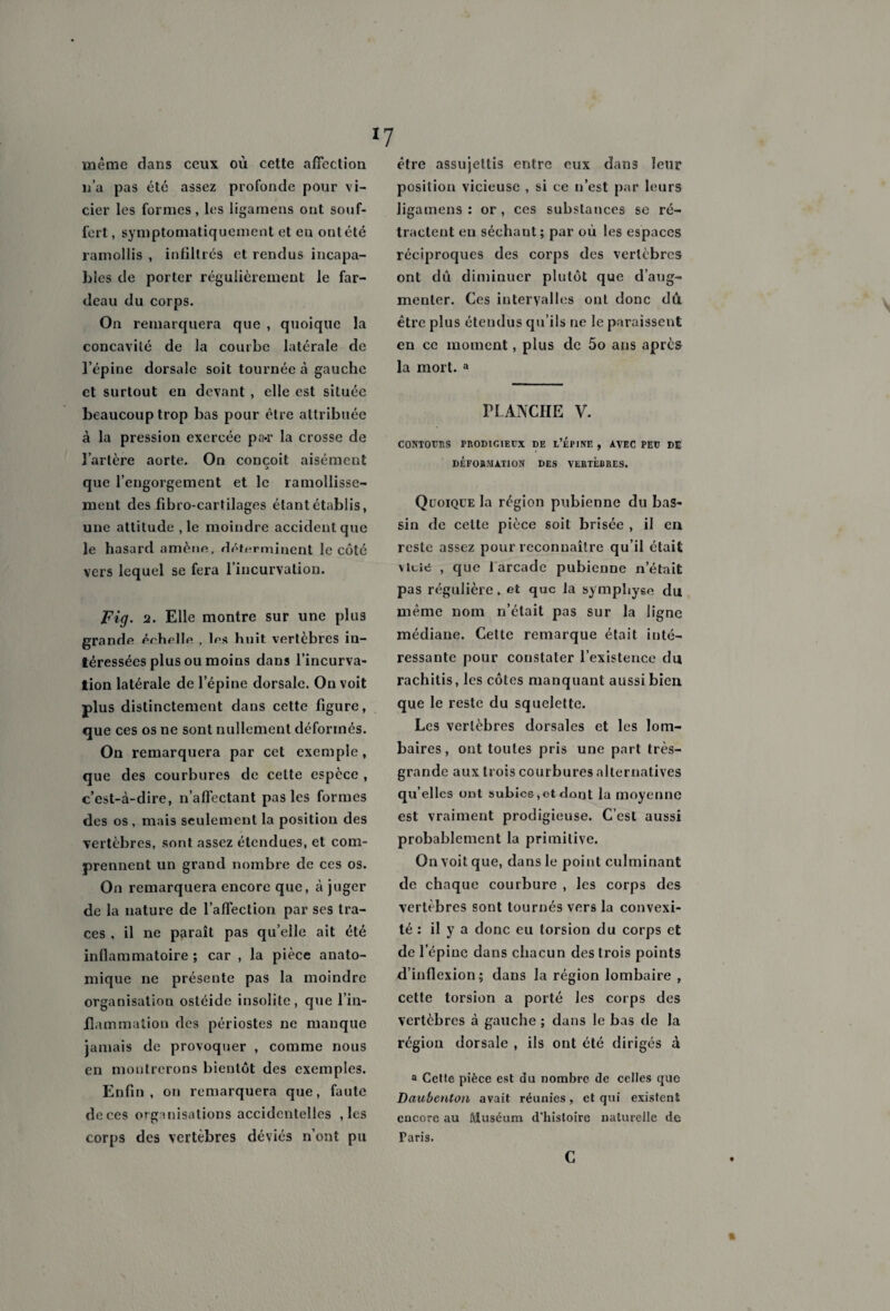 même dans ceux où cette affection n’a pas été assez profonde pour vi¬ cier les formes, les ligamens ont souf¬ fert, symptomatiquement et en ontété ramollis , infiltrés et rendus incapa¬ bles de porter régulièrement le far¬ deau du corps. On remarquera que , quoique la concavité de la courbe latérale de l’épine dorsale soit tournée à gauche et surtout en devant , elle est située beaucoup trop bas pour être attribuée à la pression exercée pa«r la crosse de l’artère aorte. On conçoit aisément que l’engorgement et le ramollisse¬ ment des fibro-cartilages étant établis, une attitude , le moindre accident que le hasard amène, déterminent le côté vers lequel se fera l’incurvation. Fig. 2. Elle montre sur une plus grande érhelle , les huit vertèbres in¬ téressées plus ou moins dans l’incurva¬ tion latérale de l’épine dorsale. On voit plus distinctement dans cette figure, que ces os ne sont nullement déformés. On remarquera par cet exemple , que des courbures de celte espèce , c’est-à-dire, n’affectant pas les formes des os , mais seulement la position des vertèbres, sont assez étendues, et com¬ prennent un grand nombre de ces os. On remarquera encore que, à juger de la nature de l’affection par ses tra¬ ces , il ne paraît pas qu’elle ait été inflammatoire ; car , la pièce anato¬ mique ne présente pas la moindre organisation ostéide insolite, que l’in¬ flammation des périostes ne manque jamais de provoquer , comme nous en montrerons bientôt des exemples. Enfin, on remarquera que, faute de ces organisations accidentelles , les corps des vertèbres déviés n’ont pu être assujettis entre eux dans leur position vicieuse , si ce n’est par leurs ligamens : or , ces substances se ré¬ tractent eu séchant; par où les espaces réciproques des corps des vertèbres ont dû diminuer plutôt que d’aug¬ menter. Ces intervalles ont donc dû être plus étendus qu’ils ne le paraissent en ce moment, plus de 5o ans après la mort. a PLANCHE V. CONTOURS PRODIGIEUX DE L’ÉlUNE , AVEC PEU DE DÉFORMATION DES VERTEBRES. Quoique la région pubienne du bas¬ sin de celte pièce soit brisée , il en reste assez pour reconnaître qu’il était viole , que 1 arcade pubienne n’était pas régulière, et que fa symphyse du même nom n’était pas sur la ligne médiane. Cette remarque était inté¬ ressante pour constater l’existence du rachitis, les côtes manquant aussi bien que le reste du squelette. Les vertèbres dorsales et les lom¬ baires , ont toutes pris une part très- grande aux trois courbures alternatives qu’elles ont subies ,ot dont la moyenne est vraiment prodigieuse. C’est aussi probablement la primitive. On voit que, dans le point culminant de chaque courbure , les corps des vertèbres sont tournés vers la convexi¬ té : il y a donc eu torsion du corps et de l’épine dans chacun des trois points d’inflexion; dans la région lombaire , cette torsion a porté les corps des vertèbres à gauche ; dans le bas de la région dorsale , ils ont été dirigés à a Cette pièce est du nombre de celles que Daubenlon avait réunies, et qui existent encore au Muséum d'histoire naturelle de Taris. c