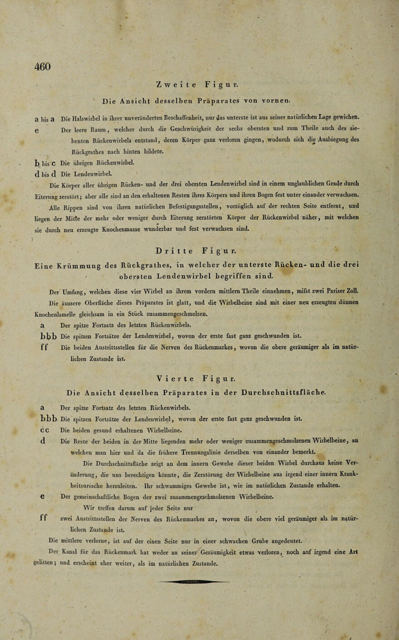 Zweite Figur. Die Ansicht desselben Präparates von vornem 3 bis a Die Halswirbel in ihrer unveränderten Beschaffenheit, nur das unterste ist aus seiner natürlichen Lage gewichen, e Der leere Raum, welcher durch die Geschwürigkeit der sechs obersten und zum Theile auch des sie¬ benten Rückenwirbels entstand, deren Körper ganz verloren gingen, wodurch sich die Ausbiegung des Rückgrathes nach hinten bildete, b bis C Die übrigen Rückenwirbel, d bis d Die Lendenwirbel. Die Körper aller übrigen Rücken- und der drei obersten Lendenwirbel sind in einem unglaublichen Grade durch Eiterung zerstört; aber alle sind an den erhaltenen Resten ihres Körpers und ihren Bogen fest unter einander verwachsen. Alle Rippen sind von ihren natürlichen Befestigungsstellen, vorzüglich auf der rechten Seite entfernt, und liegen der Mitte der mehr oder weniger durch Eiterung zerstörten Körper der Rückenwirbel näher, mit welchen sie durch neu erzeugte Knochenmasse wunderbar und fest verwachsen sind. Dritte Figur. Eine Krümmung des Rückgrathes, in welcher der unterste Rücken- und die drei - obersten Lendenwirbel begriffen sind. Der Umfang, welchen diese vier Wirbel an ihrem vordem mittlern Theile einnehmen, mifst zwei Pariser Zoll. Die äussere Oberfläche dieses Präparates ist glatt, und die Wirbelbeine sind mit einer neu erzeugten dünnen Knochenlamelle gleichsam in ein Stück zusammengeschmolzen, a Der spitze Fortsatz des letzten Rückenwirbels. blpb Die spitzen Fortsätze der Lendenwirbel, wovon der erste fast ganz geschwunden ist. f f Die beiden Austrittsstellen für die Nerven des Rückenmarkes, wovon die obere geräumiger als im natür¬ lichen Zustande ist. Vierte Figur. Die Ansicht desselben Präparates in der Durchschnittsfläche. a Der spitze Fortsatz des letzten Rückenwirbels. t bbb Die spitzen Fortsätze der Lendenwirbel, wovon der erste fast ganz geschwunden ist. . . , . • ' i ’4 CC Die beiden gesund erhaltenen Wirbelbeine. d. Die Reste der beiden in der Mitte liegenden mehr oder weniger zusammengeschmolzenen Wirbelbeine, an welchen man hier und da die frühere Trennungslinie derselben von einander bemerkt. Die Durchschnittsfläche zeigt an dem innern Gewebe dieser beiden Wirbel durchaus keine Ver¬ änderung, die uns berechtigen könnte, die Zerstörung der Wirbelbeine aus irgend einer innern Krank¬ heitsursache herzuleiten. Ihr schwammiges Gewebe ist, wie im natürlichen Zustande erhalten, e Der gemeinschaftliche Bogen der zwei zusammengeschmolzenen Wirbelheine. Wir treffen darum auf jeder Seite nur ff zwei Austrittsstellen der Nerven des Rückenmarkes an, wovon die obere viel geräumiger als im natür¬ lichen Zustande ist. Die mittlere verlorne, ist auf der einen Seite nur in einer schwachen Grube angedeutet. Der Kanal für das Rückenmark hat weder an seiner Geräumigkeit etwas verloren, noch auf irgend eine Art gelitten; und erscheint eher weiter, als im natürlichen Zustande.