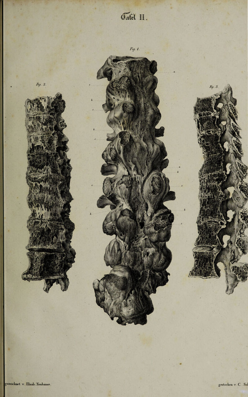 II •T ezeicluiet v. Elisab. Neubauer. gestochen v. C . Sei