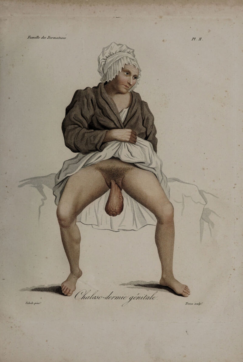 ' * J‘anu//e t/es Dermatoses P/. H. *