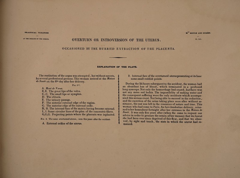 OF THE DISEASES OF THE UTERUS. OVERTURN OR INTROVERSION OF THE UTERUS, PL. XII. OCCASIONED BY THE HURRIED EXTRACTION OF THE PLACENTA. Explanation The restitution of the organ was attempted , but without succets, by several professional persons. This woman arrived at the Maison de Santé on the 6th day after her delivery. Fig. I1. A. Mont de Venus. B. B. The great lips of the vulva. C. C. The small lips or nymphœ. D. The clitoris. E. The urinary passage. F. The anterior external edge of the vagina. G. The anterior edge of the external orific. H. H. The internal face of the matrix having become external. I. I. Some circulor lines of the plan of the concentric fibres. G,G,G. Projecting points where the placenta was inplanted. Fig. 2. The same overturned uterus, seen five years after the accident. A. External orifice of the uterus. OF THE PLATE. S B. Internal face of the overturned uterus presenting at its base | some small reddish points. | During the 24 hours subsequent to the accident, the woman had I an abundant loss of blood, which terminated in a profound I long symcope.Not only the hemorrhagy had ceased, but there was | not any more red lochia. The impossibility of making water and $ the consequent suffering were the only accidents which accompa- f nied this serious event. Not being able to succeed in the reduction, I and the excretion of the urine taking place soon after without as- | sistance, the rest was left to the resources of nature and time. This § woman who had come to Paris, for her clandestine delivery, retur- ! nedtoher homeabout fortnight after her entrance in the Maison de S Santé. It was only five years after (when the came to request our * advice in order to procure the return of her menses) thot we learnt , she had been ever since deprived of this flow, and that we obser- $ ved, by sight and touch, the state in which the uterus had re- * mained.