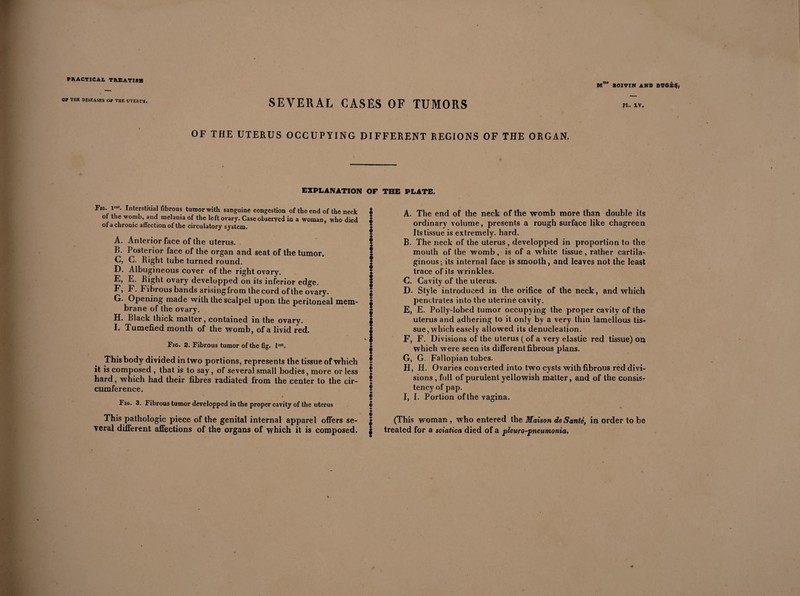 BOIVÏN AND DT7GÈ$y SEVERAL CASES OF TUMORS OF THE UTERUS OCCUPYING DIFFERENT REGIONS OF THE ORGAN. PL. XV, EXPLANATION OP THE PLATE, Fig. lr!t. Interstitial fibrous tumor with sanguine congestion of the end of the neck $ of the womb, and melania of the left ovary. Case observed in a woman, who died f of a chronic affection of the circulatory system. ^ A. Anterior face of the uterus. | B. Posterior face of the organ and seat of the tumor. I C. G. Bight tube turned round. ! D. Albugineous cover of the right ovary. | E. E. Bight ovary developped on its inferior edge. f Fj F. Fibrous bands arisingfrom the cord of the ovary. s G. Opening made with the scalpel upon the peritoneal mem- | brane of the ovary. I H. Black thick matter, contained in the ovary. $ I. Tumefied month of the womb, of a livid red. | Fig. 2. Fibrous tumor of the fig. Irst. | This body divided in two portions, represents the tissue of which | it is composed , that is to say, of several small bodies, more or less ! hard, which had their fibres radiated from the center to the cir- ! cumference. | _ 8 Fig. 3. Fibrous tumor developped in the proper cavity of the uterus « • This pathologic piece of the genital internal apparel offers se- | veral different affections of the organs of which it is composed. | A, The end of the neck of the womb more than double its ordinary volume, presents a rough surface like chagreen Its tissue is extremely, hard. B, The neck of the uterus, developped in proportion to the mouth of the womb, is of a white tissue, rather cartila¬ ginous; its internal face is smooth, and leaves not the least trace of its wrinkles. C, Cavity of the uterus. D, Style introduced in the orifice of the neck, and which penetrates into the uterine cavity. E, E. Polly-lobed tumor occupying the proper cavity of the uterus and adhering to it only by a very thin lamellous tis¬ sue , which easely allowed its denucleation. F, F. Divisions of the uterus ( of a very elastic red tissue) on which were seen its different fibrous plans. G, G. Fallopian tubes. H, H. Ovaries converted into two cysts with fibrous red divi¬ sions , full of purulent yellowish matter, and of the consis? tency of pap. I, I. Portion of the vagina. (This woman , who entered the Maison de Santé, in order to be treated for a sciatica died of a pleuro-pneumonia.