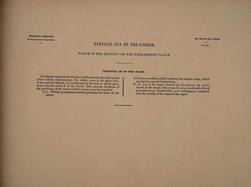 e - , Practical treatise iff THE DISEASES OF THE UTERUS. Mmi BOIVIN AND DUGÈS. VERTICAL CUT OF THE UTERUS, ii„. WHICH IS THE SUBJECT OF THE PJRECEEDING PLATE. EXPLANATION OF THE PLATE. This figure represents the thickness of the anterior lip of the mouth bf the womb , and its extent. The orifice , seen in the plate XXI is here placed behind ; it is indicated by the style A, which pene¬ trates into the cavity B of the uterus. The extreme thickness of the partitions of the bodies of this viscera , may be remarked. C,C. Whitish granulations which penetrate the tissue of the uterus. f E- Numerous orifices of the vessels of the uterine cavity, which Î produced a mortal hemorrhagy. D , D. Cut of the tumor formed by the anterior lip of the mouth of the womb. There may be seen a multitude of hard granulations of a bluish white, as if cartilaginous, crammed * into the totality of the tissue of the organ.