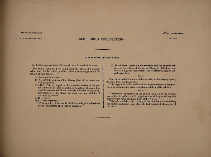 OF THE DISEASES OF THE UTERUS. SCHIRRHOUS TUMEFACTION. PL. XXIII. EXPLANATION OF THE PLATE. Fie. 1. Schirrhous tumefaction of the posterior lip of the mouth of the womb. This tumefaction has been found upon the uterus of a woman who died of tuberculous phthisis, after a miscarriage at the 6th month of pregnancy. A. Bottom of the uterus. 33. Palmaied disposition of the fibrous plans of the uterus du¬ ring pregnancy. C,C,C,C. Tubes grouped on the posterior surface of the ute¬ rus , and each of them describing a handle in which are fra¬ med the ovaries which are strongly adherent to the poste¬ rior division of the uterus, by numerous morbid folds of the large ligaments. 1),D. Ovaries. E, E. Large ligaments. F. Posterior lip of the mouth of the womb , of a schirrhous tissue , and nearly of an inch in thicknéss. * f I I « I I * I f f § ! § ! § I { G. Hitaditiforn tumor on the superior and the exterior left angle of the bottom of the uterus. This cyst, of the form and size of a fig, was transparent and contained a serous and yellowish-fluid. Fig. 2. Schirrhous end of the neck of the womb; orifice largely open ; its edges thin, hard, and cut. This disposition which was found in a woman eminently lympha¬ tic, was accompanied with very abundant flow of the whites. Fig. 3. Tumefaction; induration of the end of the neck of the womb, strewed on its surface with livid points, on a violet ground , equally accompanied with abundant flow of the whites. This lady was fair , pale , having all her muscles soft and flabby ; her mother and sister , thus affected , had both died of a cancer of the matrix.