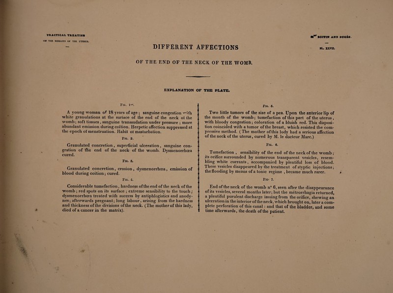 OT THE DISEASES OF TIIE UTERUS. DIFFÉRENT AFFECTIONS BOXVXXf AMD DÜGÈ8. PL. XXVII. OF THE END OF THE NECK OF THE WOMB. EXPLANATION OF THE PLATE. Fig. lr“. I A young woman of IS years of age ; sanguine congestion vHth | white granulations at the surface of the end of the neck ot the J womb; soft tissues , sanguine transsudation under pressure ; more | abundant emission during coition. Herpetic affection suppressed at | the epoch of menstruation. Habit of masturbation. | „ A F/g. 2. f I Granulated concretion, superficial ulceration, sanguine con- f gestion of the end of the neck of the womb. Dysmenorrhœa | cured. § Fig. 3. f „ . I Granulated concretion, erosion, dysmenorrhœa, emission of § blood during coition ; cured. § Fig. 4. f $ Considerable tumefaction, hardness of the end of the neck of the | womb ; red spots on its surface ; extreme sensibility to the touch; 2 dysmenorrhœa treated with success by antiphlogistics and anody- | nes; afterwards pregnant; long labour, arising from the hardness | and thickness of the divisions of the neck. (The mother of this lady, | died of a cancer in the matrix). f Fig. 6. Two little tumors of the size of a pea. Upon the anterior lip of the month of the womb; tumefaction of this part of the uterus , with bloody congestion; coloration of a bluish red. This disposi¬ tion coincided with a tumor of the breast, which resisted the com¬ pressive method. ( The mother of this lody had a serious affection of the neck of the uterus, cured by M. le docteur Marc.) Fig. 6. Tumefaction , sensibility of the end of the neck of the womb; its orifice surrounded by numerous transparent vesicles-, resem¬ bling white currants , accompanied by plentiful loss of blood. These vesicles disappeared by the treatment of styptic injections; the flooding by means of a tonic regime , became much rarer. v Fig* 7. End of the neck of the womb n° 6, seen after the disappearance of its vesicles, several months later; but the métrorrliagia returned, a pleutiful purulent discharge issuing from the orifice, shewing an ulceration in the interior of the neck, which brought on, later a com¬ plete perforation of this canal : and that of the bladder, and some time afterwards, the death of the patient.